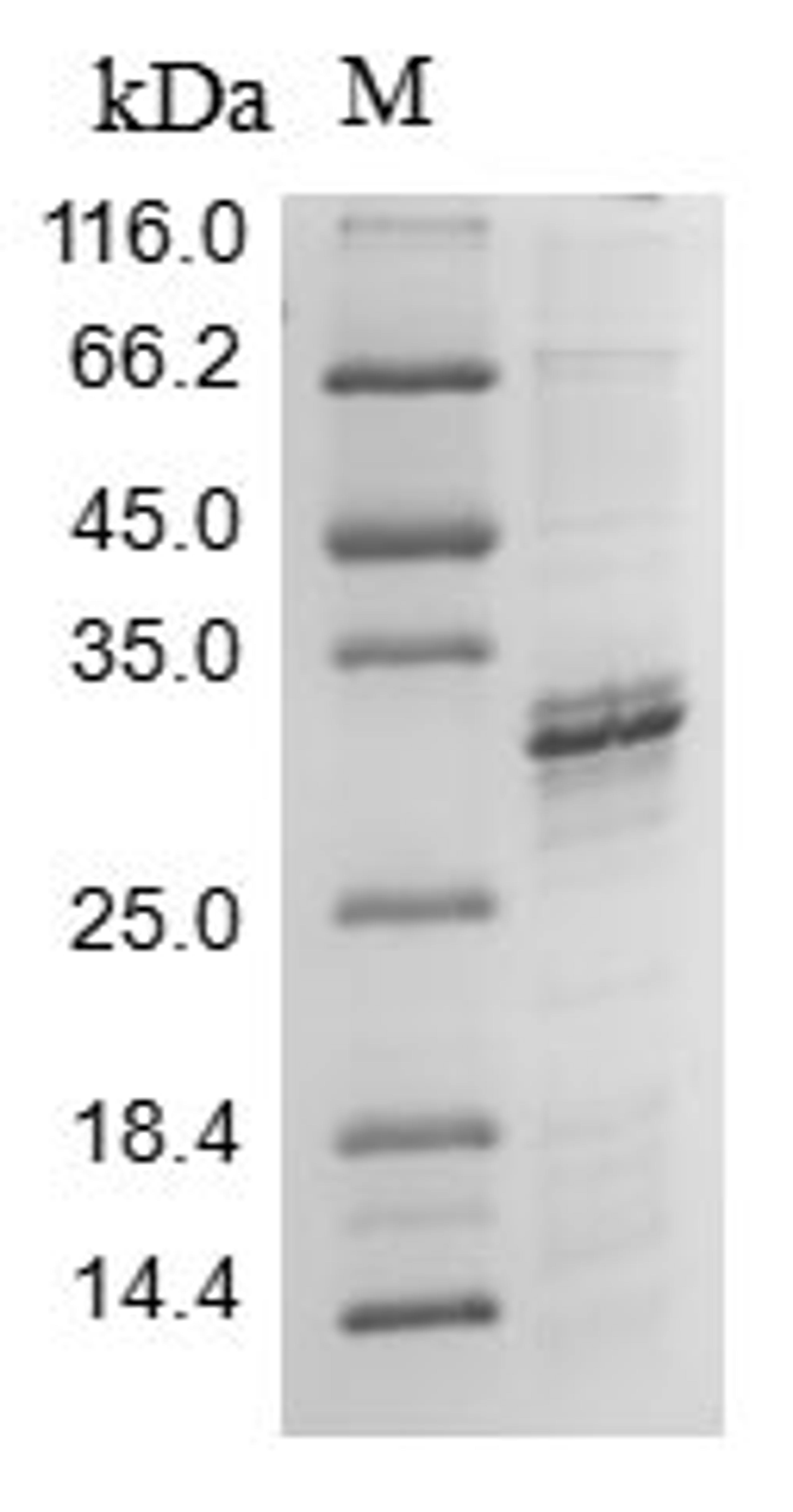 (Tris-Glycine gel) Discontinuous SDS-PAGE (reduced) with 5% enrichment gel and 15% separation gel.