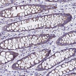 Immunohistochemistry-Paraffin: SLC4A3 Antibody [NBP1-92406] - Staining of human rectum shows moderate cytoplasmic positivity in glandular cells.