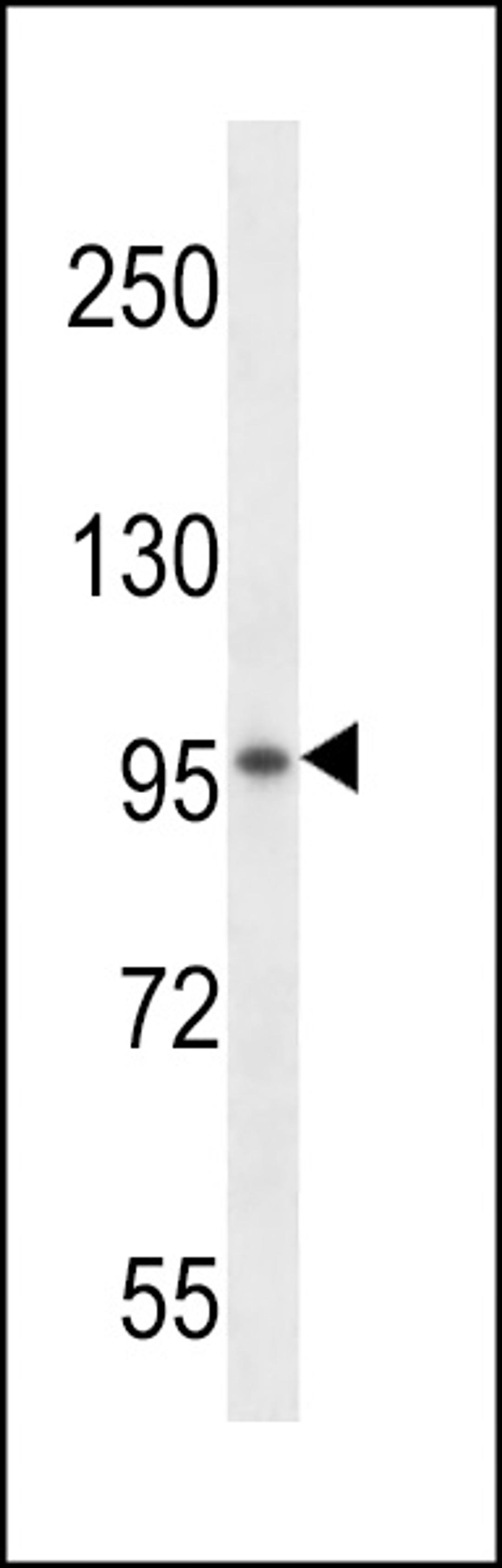 Western blot analysis in mouse kidney tissue lysates (35ug/lane).This demonstrates the detected the VSGP/F-spondin protein (arrow).