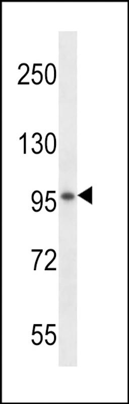 Western blot analysis in mouse kidney tissue lysates (35ug/lane).This demonstrates the detected the VSGP/F-spondin protein (arrow).