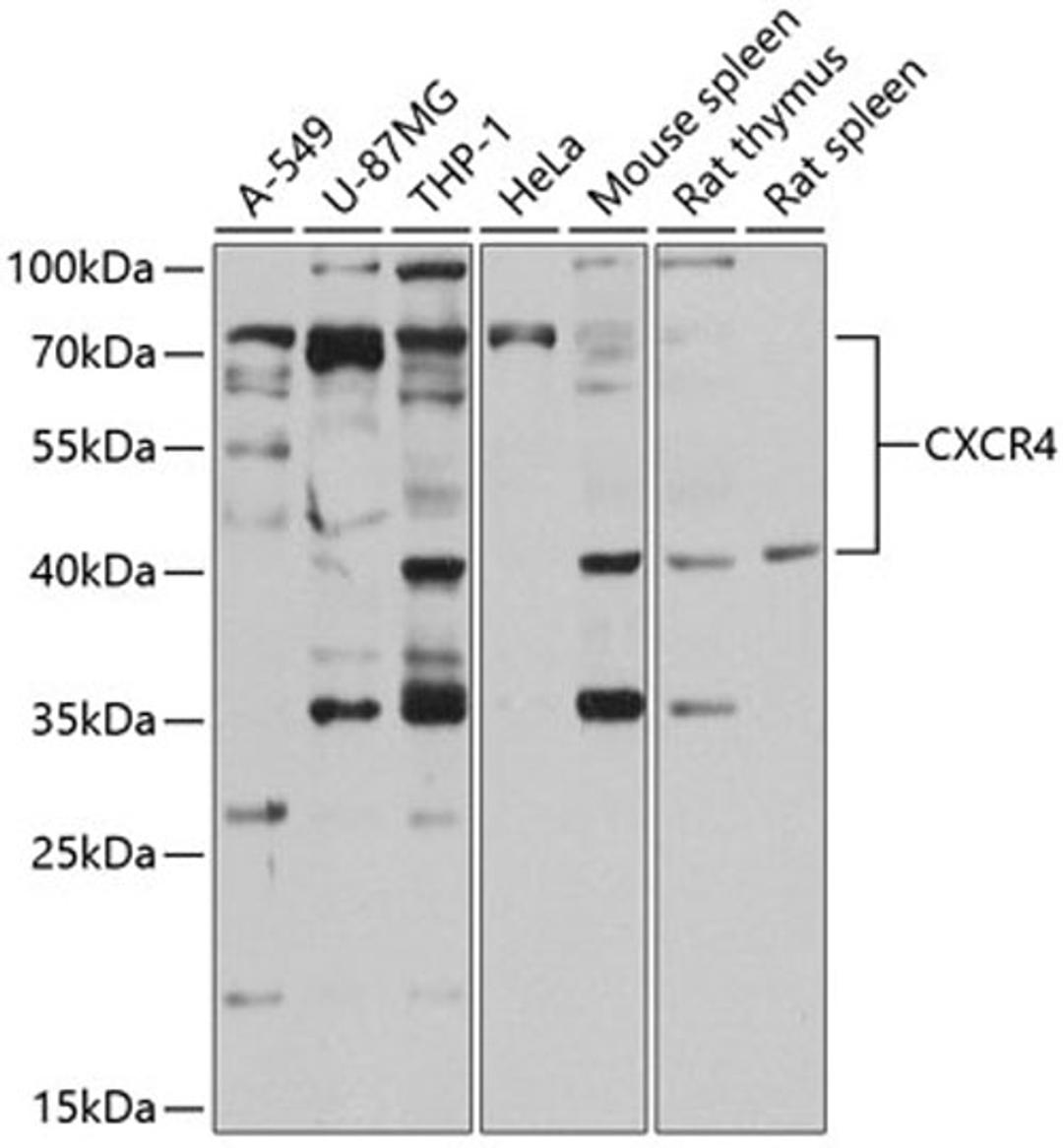 Western blot - CXCR4 antibody (A13672)