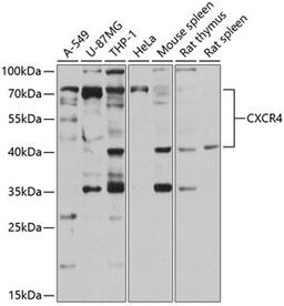 Western blot - CXCR4 antibody (A13672)