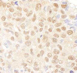 Detection of human NF-YA by immunohistochemistry.