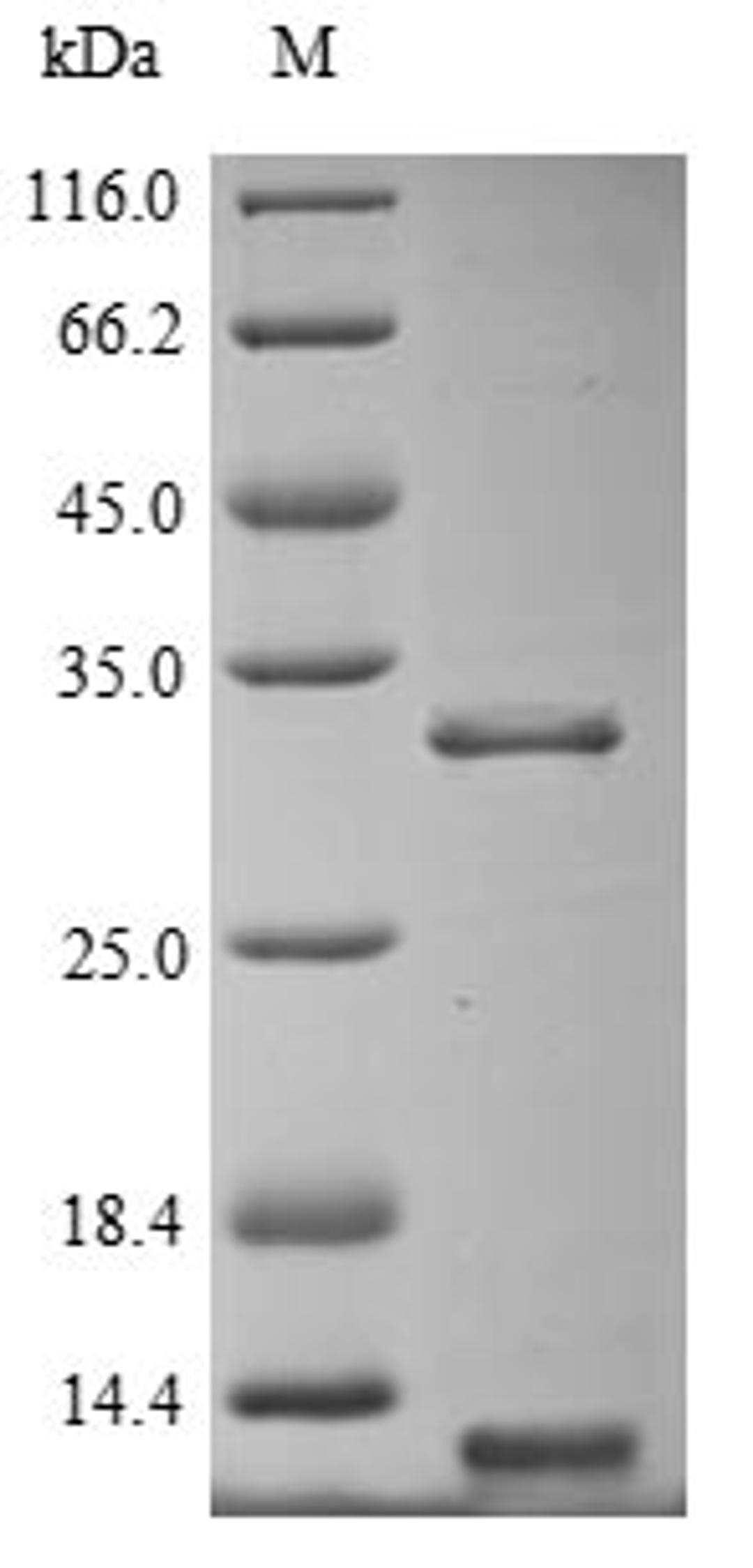 (Tris-Glycine gel) Discontinuous SDS-PAGE (reduced) with 5% enrichment gel and 15% separation gel.