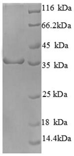 (Tris-Glycine gel) Discontinuous SDS-PAGE (reduced) with 5% enrichment gel and 15% separation gel.
