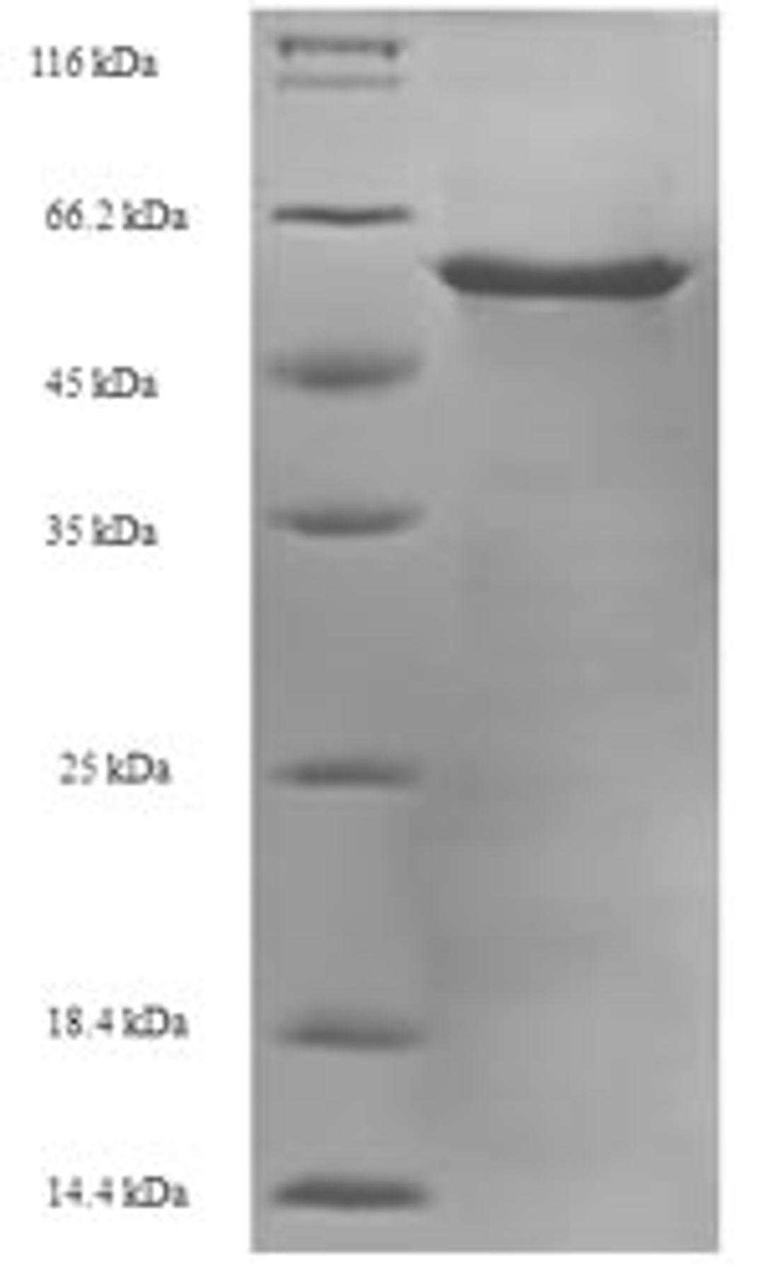 (Tris-Glycine gel) Discontinuous SDS-PAGE (reduced) with 5% enrichment gel and 15% separation gel.