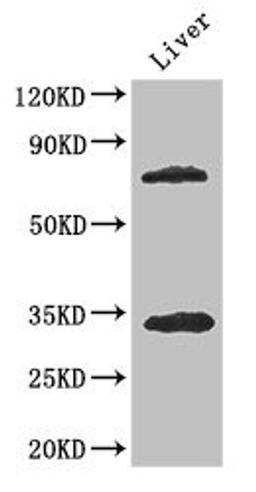 Western Blot. Positive WB detected in: Mouse liver tissue. All lanes: HDAC10 antibody at 3.4ug/ml. Secondary. Goat polyclonal to rabbit IgG at 1/50000 dilution. Predicted band size: 72, 70, 71, 44 kDa. Observed band size: 72, 34 kDa. 