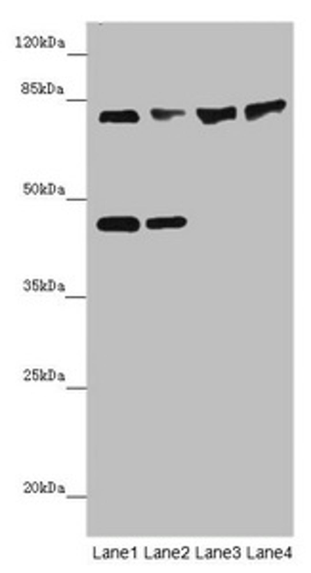 Western blot. All lanes: ZNF169antibody at 2ug/ml. Lane 1: HepG2 whole cell lysate. Lane 2: Hela whole cell lysate. Lane 3: Mouse liver tissue. Lane 4: Mouse kidney tissue. Secondary. Goat polyclonal to rabbit IgG at 1/10000 dilution. Predicted band size: 68 kDa. Observed band size: 68, 45 kDa.
