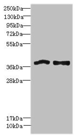 Western blot. All lanes: FPR1 antibody at 6µg/ml. Lane 1: Colo320 whole cell lysate. Lane 2: HT29 whole cell lysate. Secondary. Goat polyclonal to rabbit IgG at 1/10000 dilution. Predicted band size: 39 kDa. Observed band size: 39 kDa