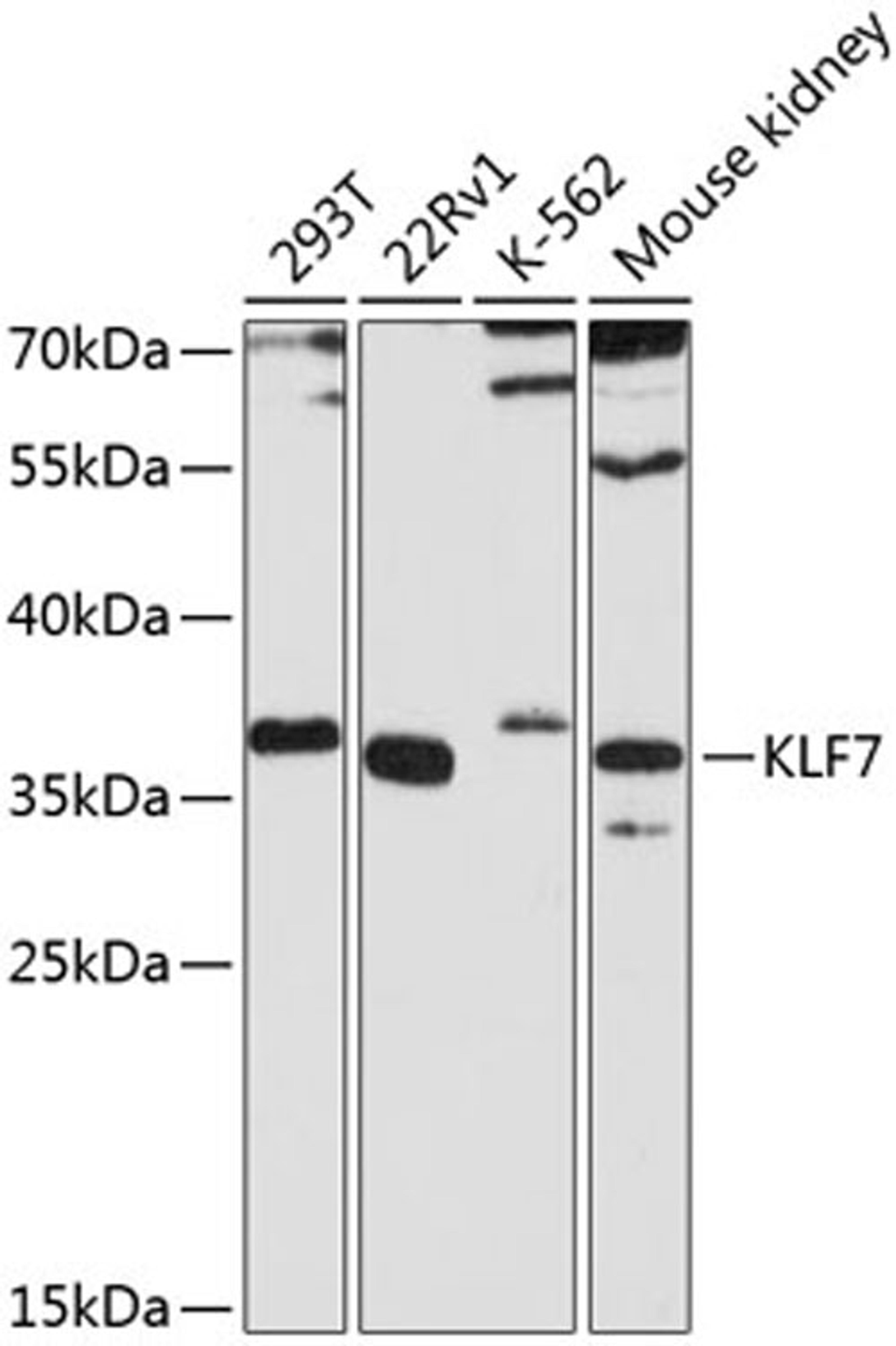 Western blot - KLF7 antibody (A8879)