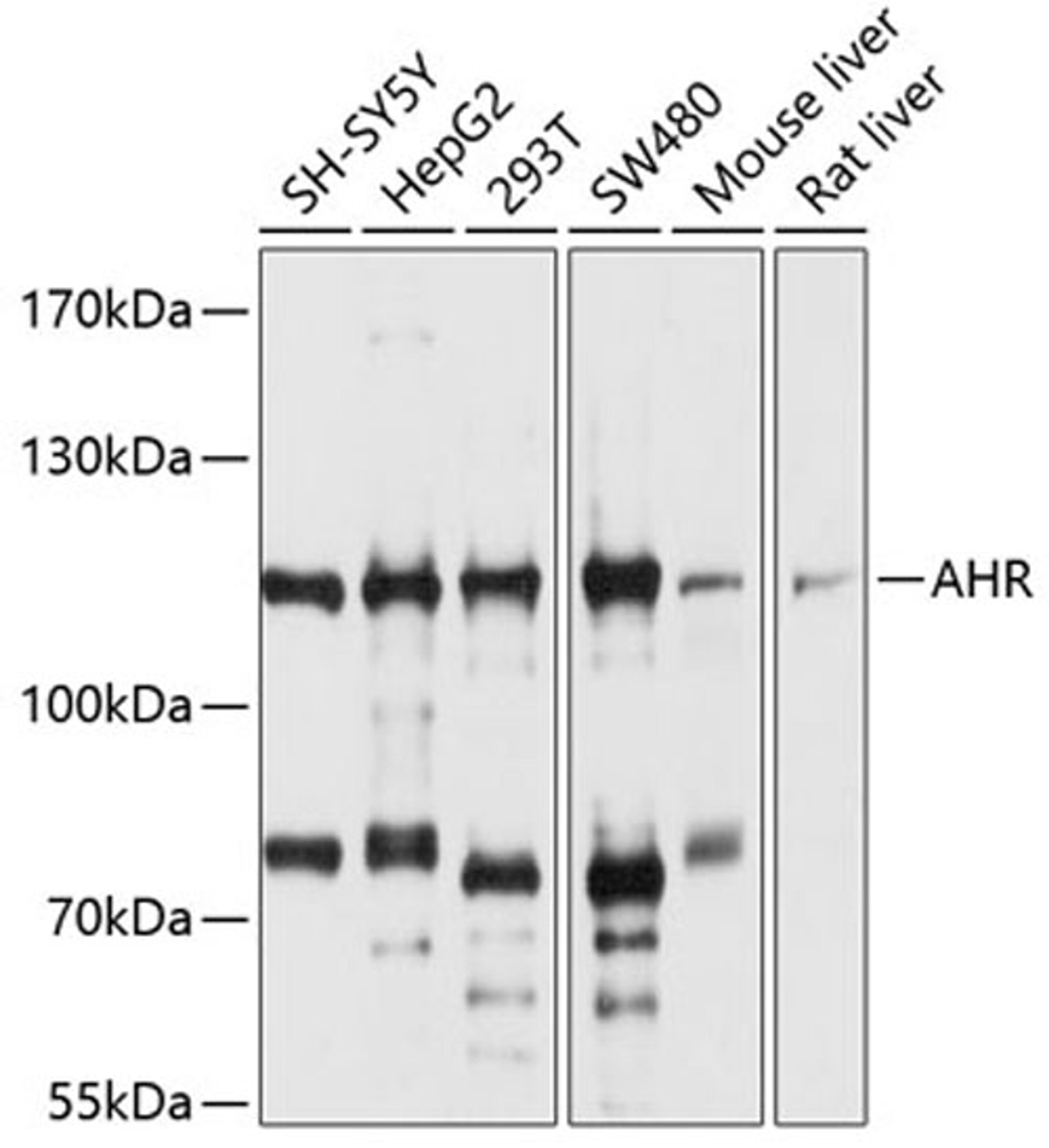 Western blot - AHR antibody (A1451)