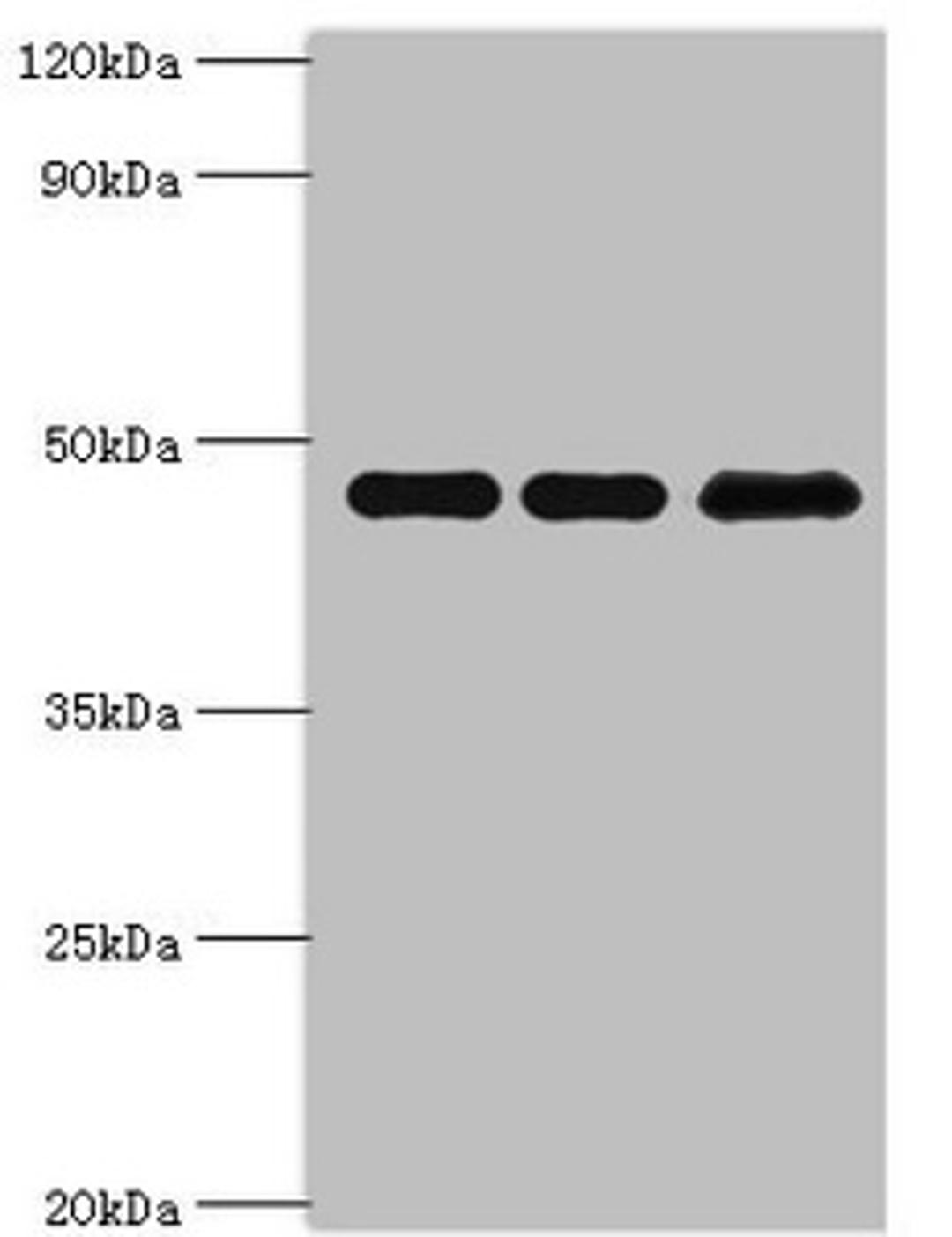 Western blot. All lanes: Phosphatidylinositol 5-phosphate 4-kinase type-2 beta antibody at 10ug/ml. Lane 1: Hela whole cell lysate. Lane 2: MCF-7 whole cell lysate. Lane 3: 293T whole cell lysate. Secondary. Goat polyclonal to rabbit IgG at 1/10000 dilution. Predicted band size: 48, 33 kDa. Observed band size: 48 kDa. 
