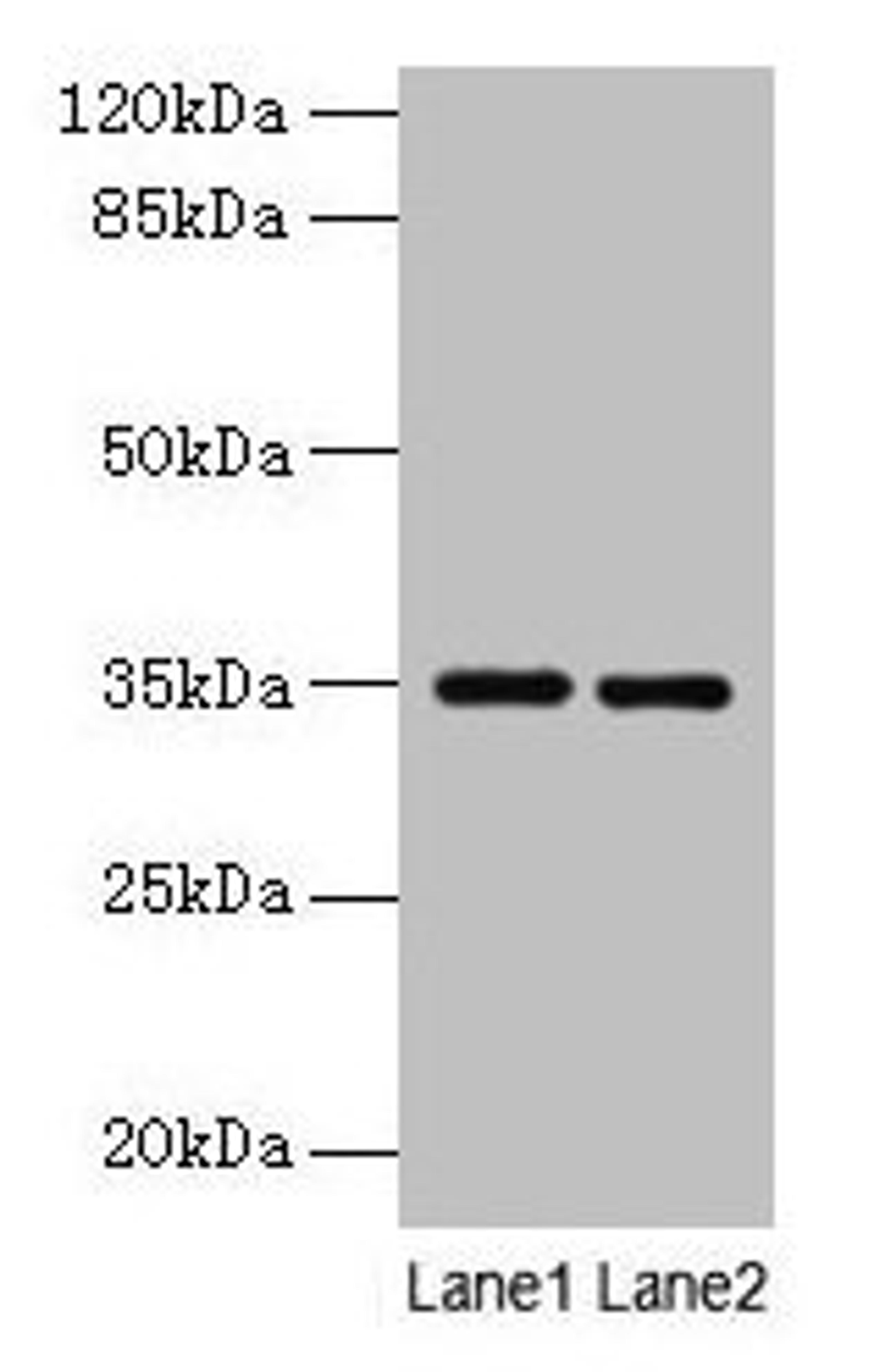 Western blot. All lanes: Thpo antibody at 4µg/ml. Lane 1: Mouse liver tissue. Lane 2: 293T whole cell lysate. Secondary. Goat polyclonal to rabbit IgG at 1/10000 dilution. Predicted band size: 35 kDa. Observed band size: 35 kDa