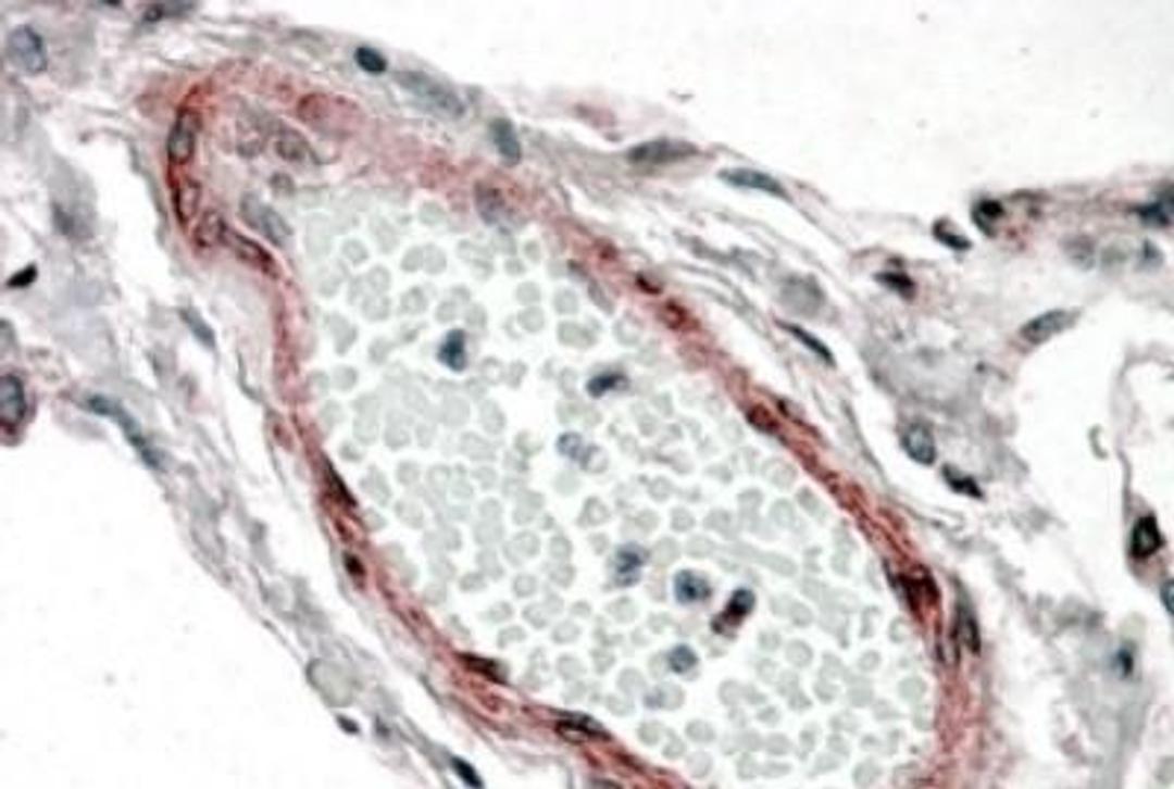 Immunohistochemistry-Paraffin: CSRP2 Antibody [NB100-77341] - Analysis of Human Lung. Steamed antigen retrieval with citrate buffer pH 6, AP-staining.