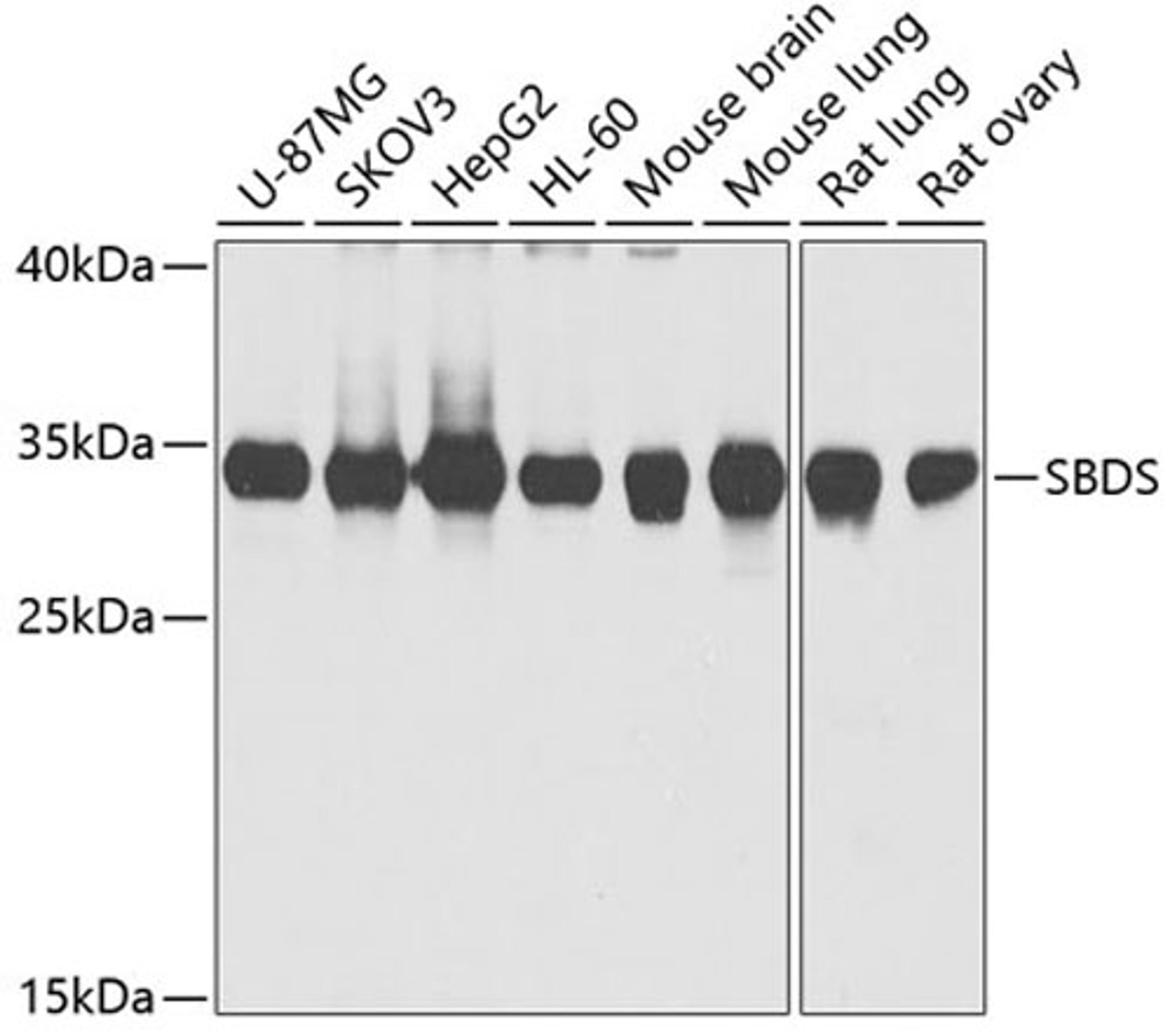 Western blot - SBDS antibody (A5876)