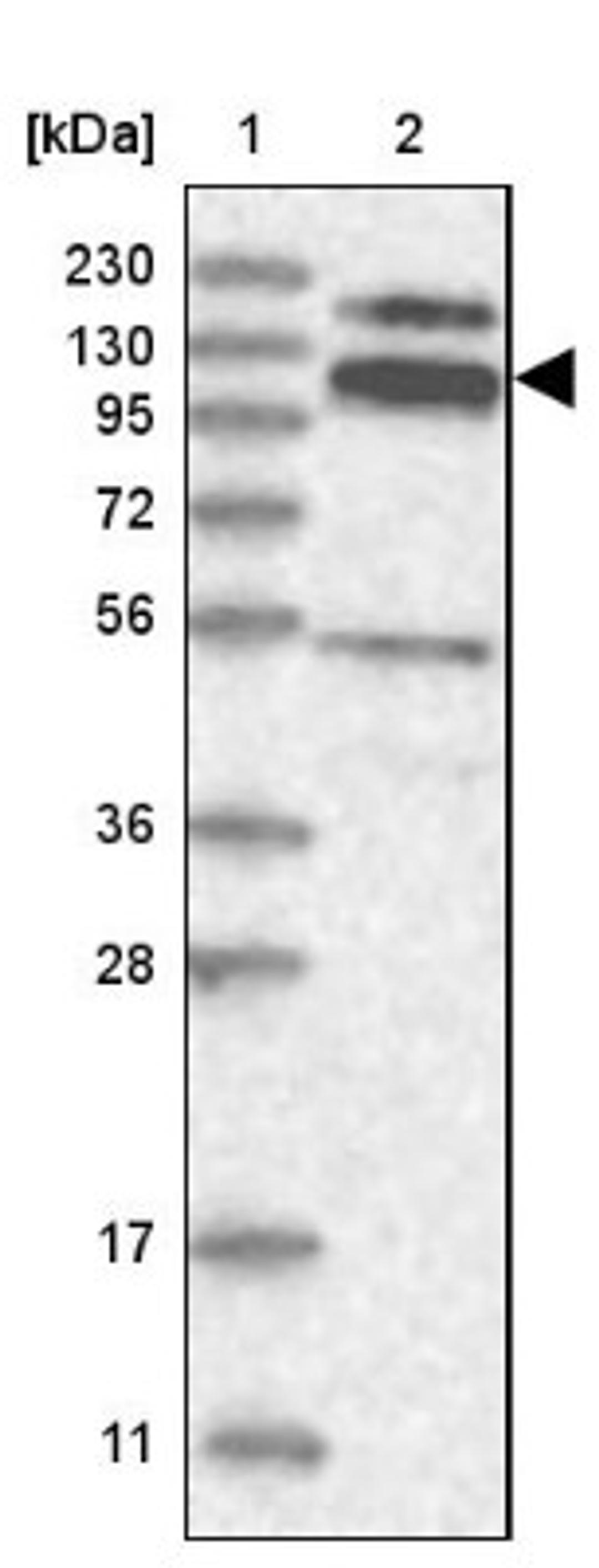 Western Blot: RBM15B Antibody [NBP1-81650] - Lane 1: Marker [kDa] 230, 130, 95, 72, 56, 36, 28, 17, 11<br/>Lane 2: Human cell line RT-4