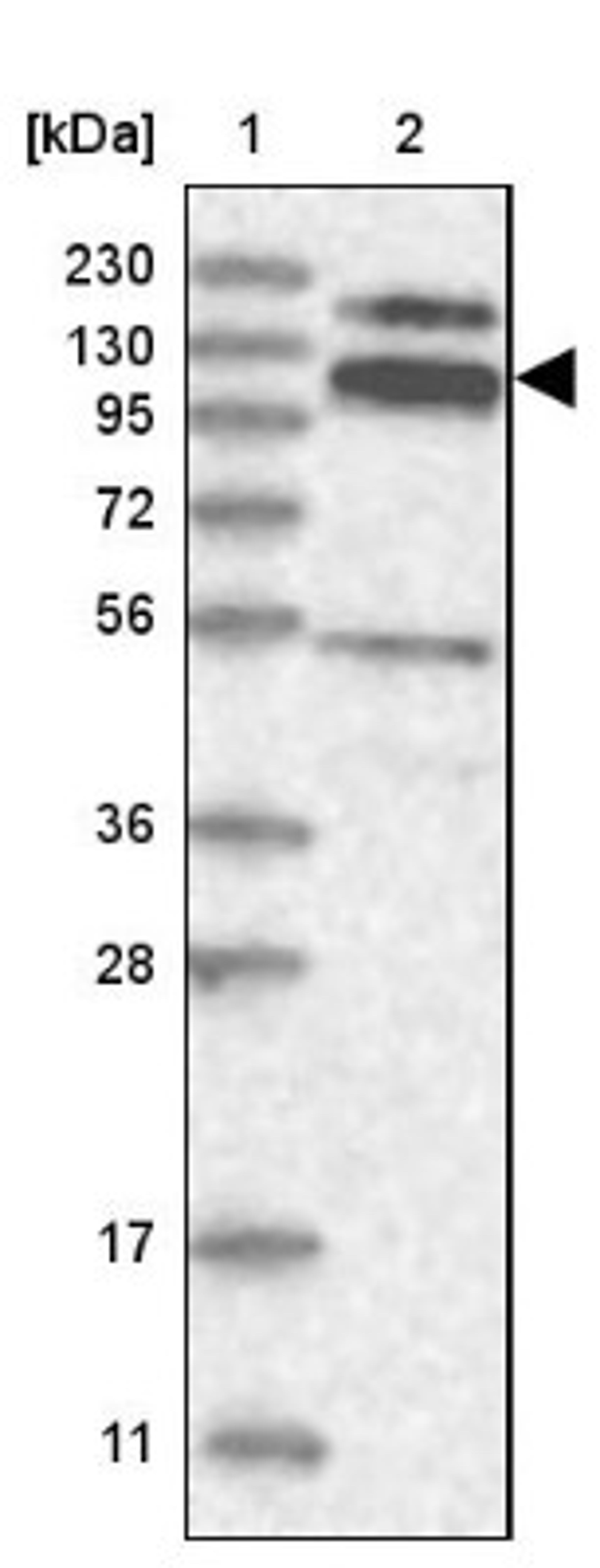 Western Blot: RBM15B Antibody [NBP1-81650] - Lane 1: Marker [kDa] 230, 130, 95, 72, 56, 36, 28, 17, 11<br/>Lane 2: Human cell line RT-4