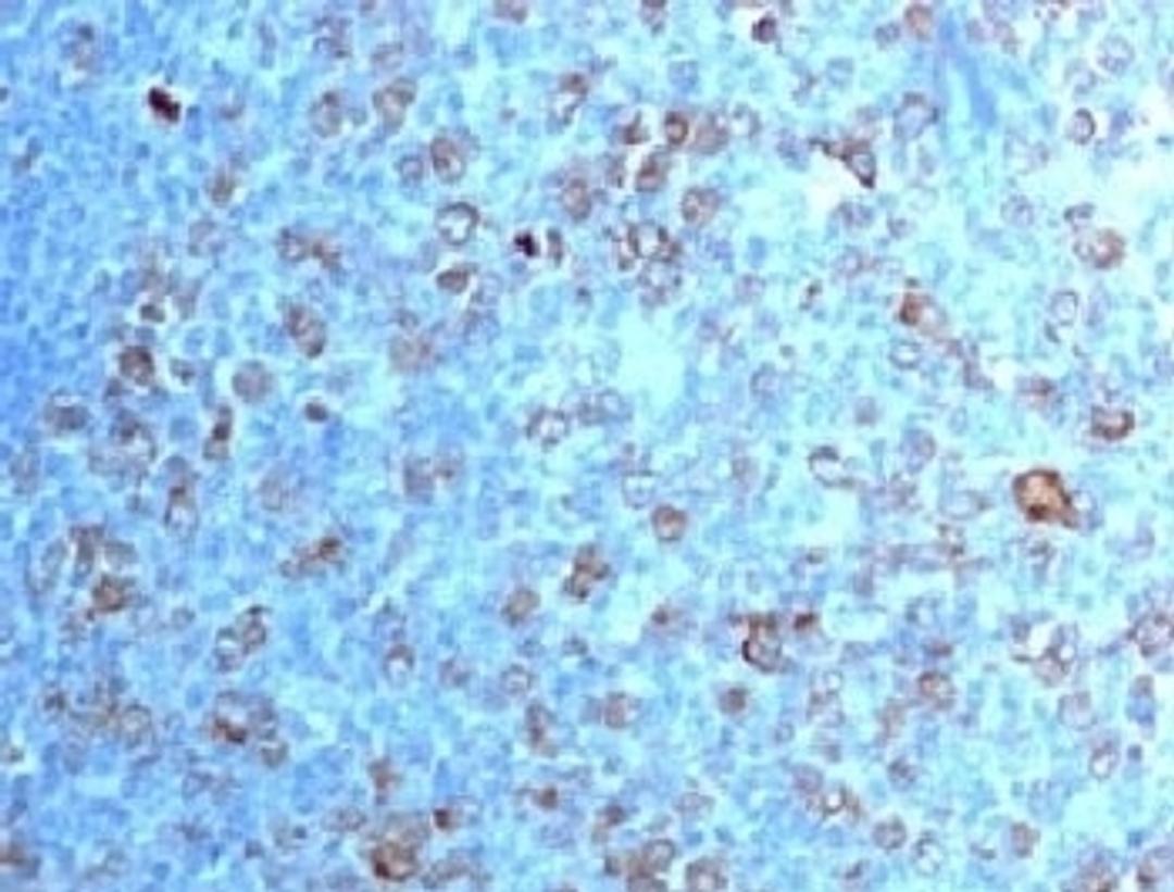 IHC testing of FFPE human tonsil with CDK1 antibody (clone CDVC2-1).