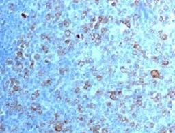 IHC testing of FFPE human tonsil with CDK1 antibody (clone CDVC2-1).