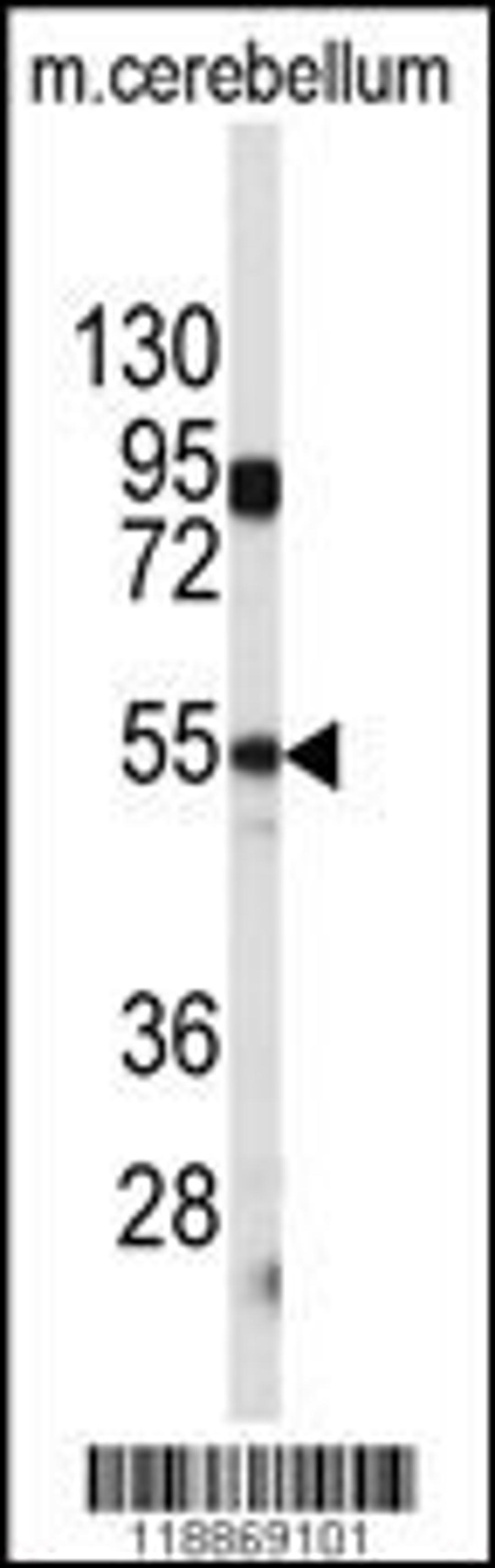 Western blot analysis of CPE antibody in mouse cerebellum tissue lysates (35ug/lane)