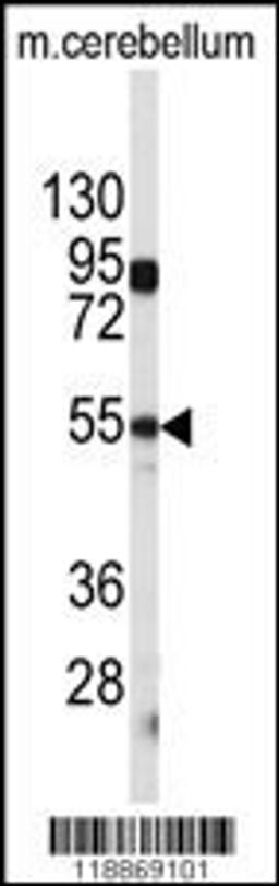 Western blot analysis of CPE antibody in mouse cerebellum tissue lysates (35ug/lane)