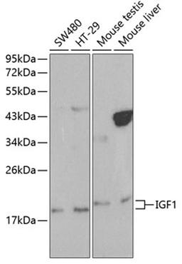 Western blot - IGF1 antibody (A0303)