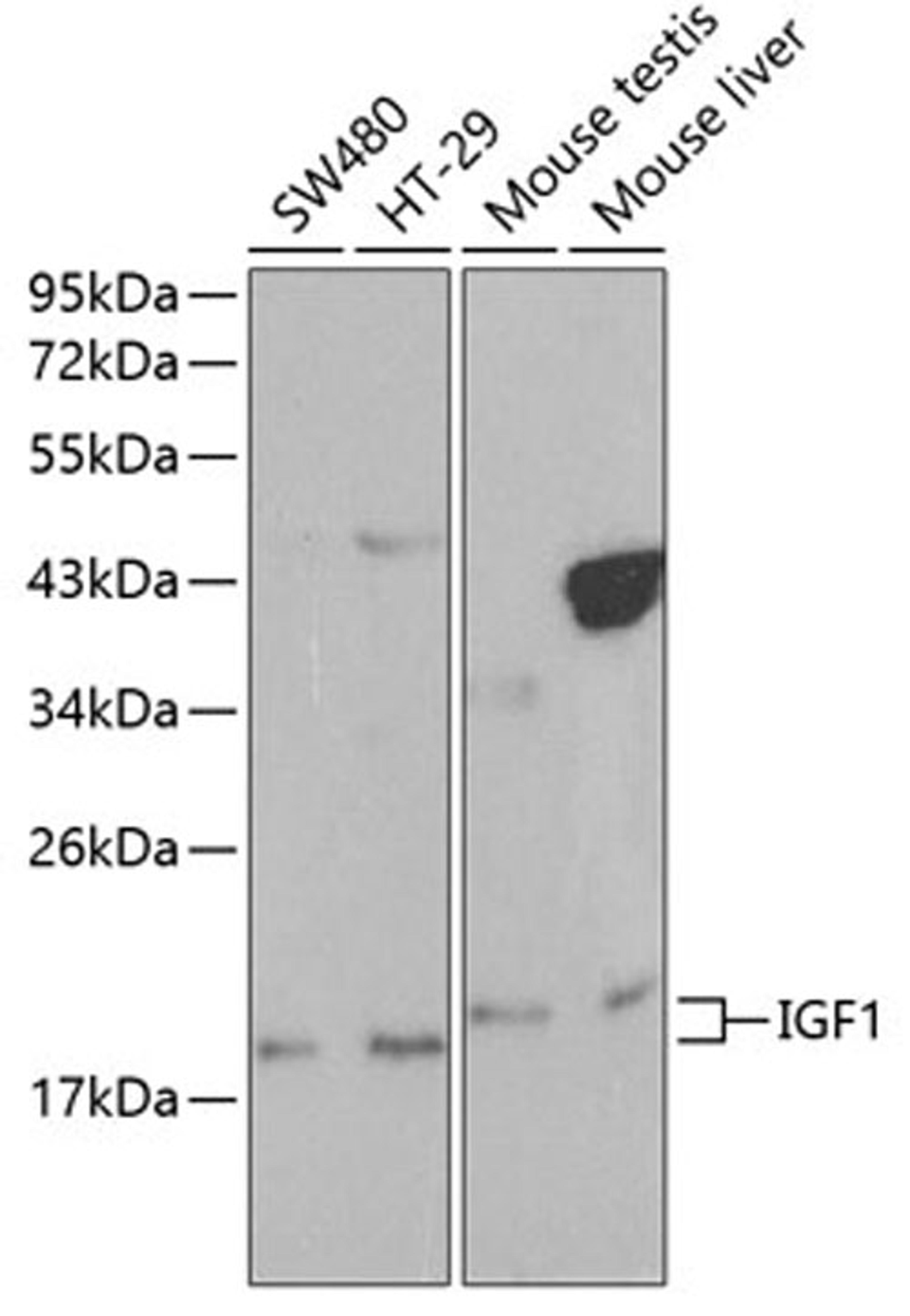 Western blot - IGF1 antibody (A0303)