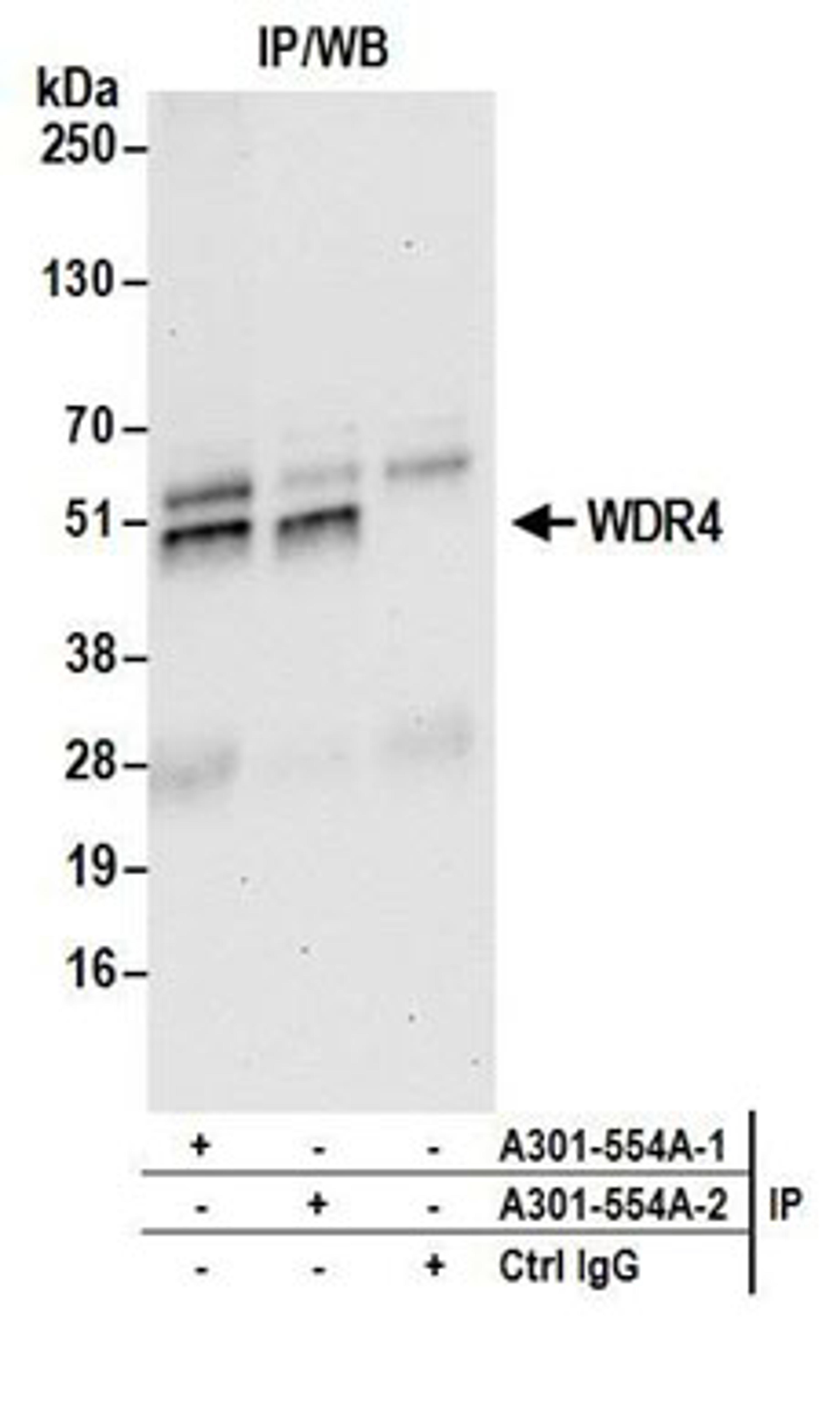 Detection of human WDR4 by western blot of immunoprecipitates.