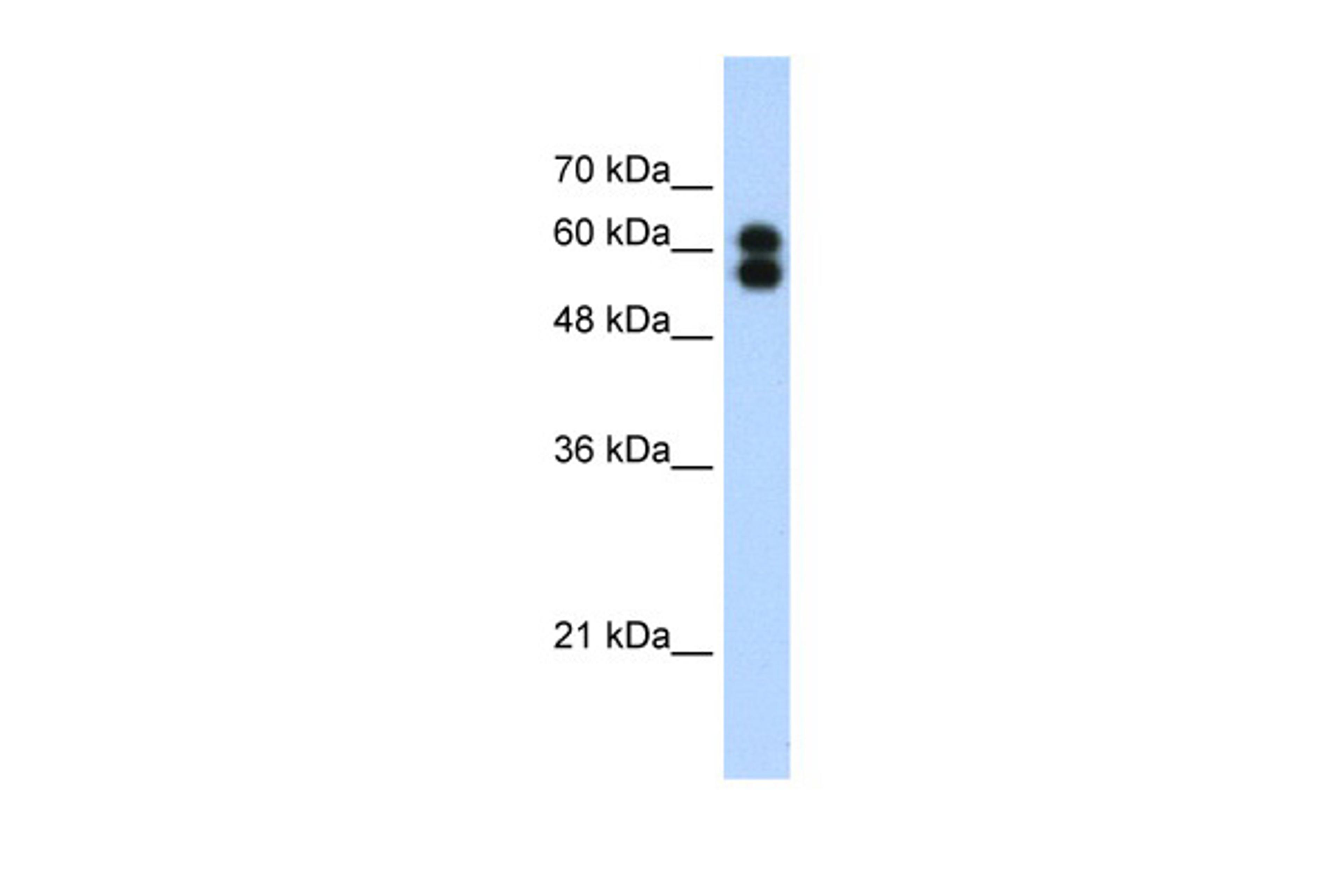 Antibody used in WB on Human HepG2 at 1.25 ug/ml.