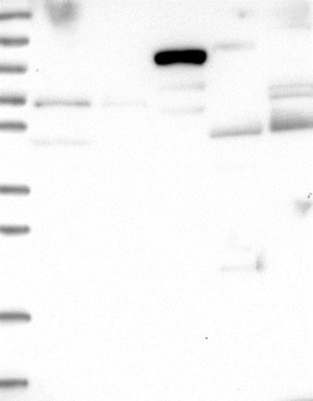 Western Blot: CCDC114 Antibody [NBP1-93863] - Lane 1: Marker [kDa] 250, 130, 95, 72, 55, 36, 28, 17, 10<br/>Lane 2: RT-4<br/>Lane 3: U-251 MG<br/>Lane 4: Human Plasma<br/>Lane 5: Liver<br/>Lane 6: Tonsil