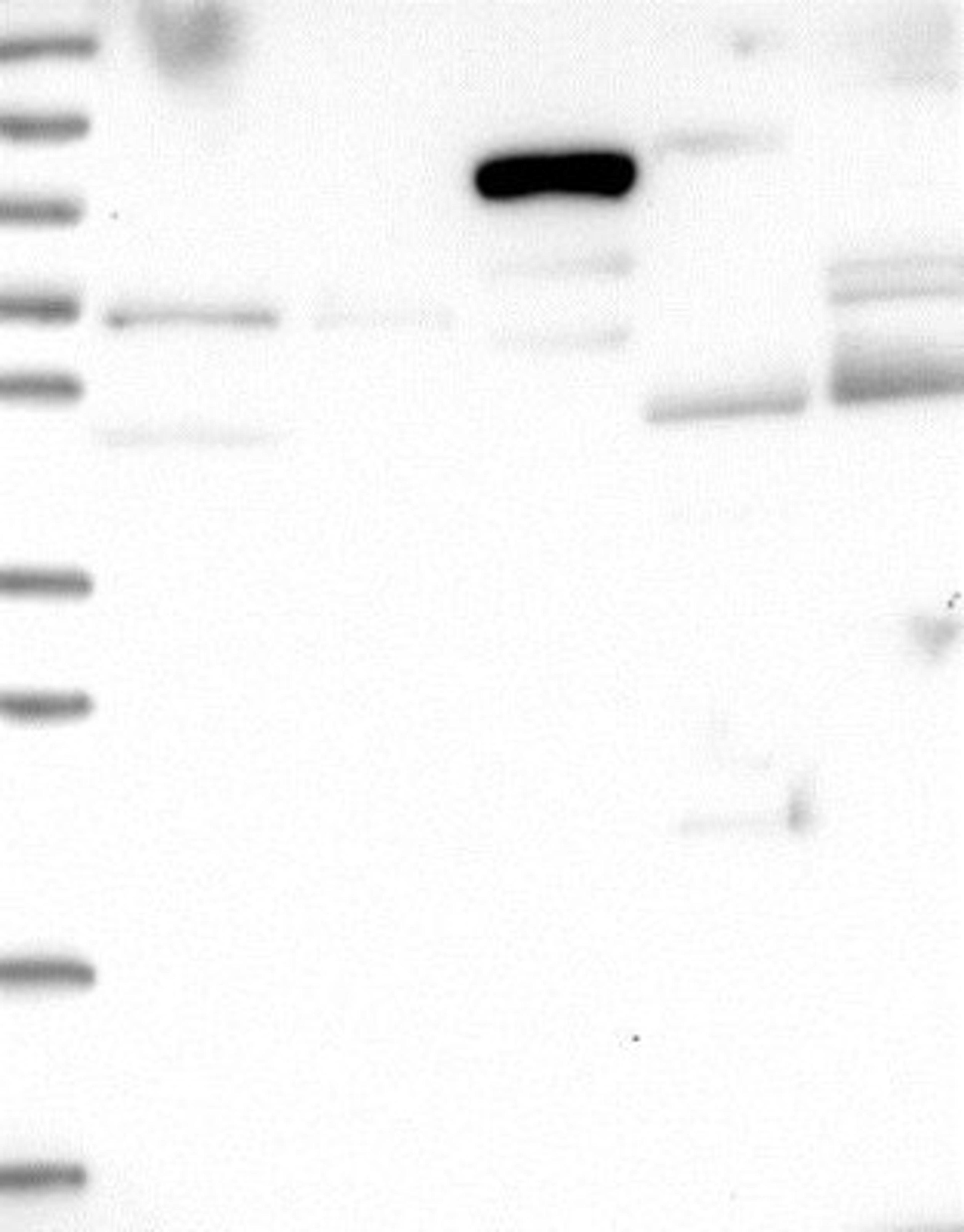 Western Blot: CCDC114 Antibody [NBP1-93863] - Lane 1: Marker [kDa] 250, 130, 95, 72, 55, 36, 28, 17, 10<br/>Lane 2: RT-4<br/>Lane 3: U-251 MG<br/>Lane 4: Human Plasma<br/>Lane 5: Liver<br/>Lane 6: Tonsil