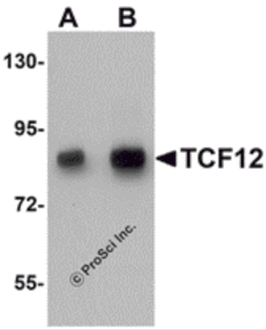 Western blot analysis of TCF12 in HeLa cell lysate with TCF12 antibody at (A) 0.5 and (B) 1 μg/mL.