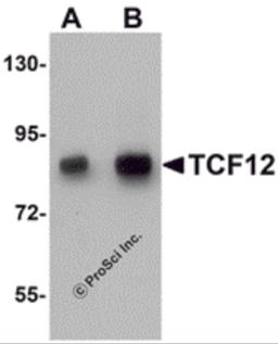 Western blot analysis of TCF12 in HeLa cell lysate with TCF12 antibody at (A) 0.5 and (B) 1 μg/mL.