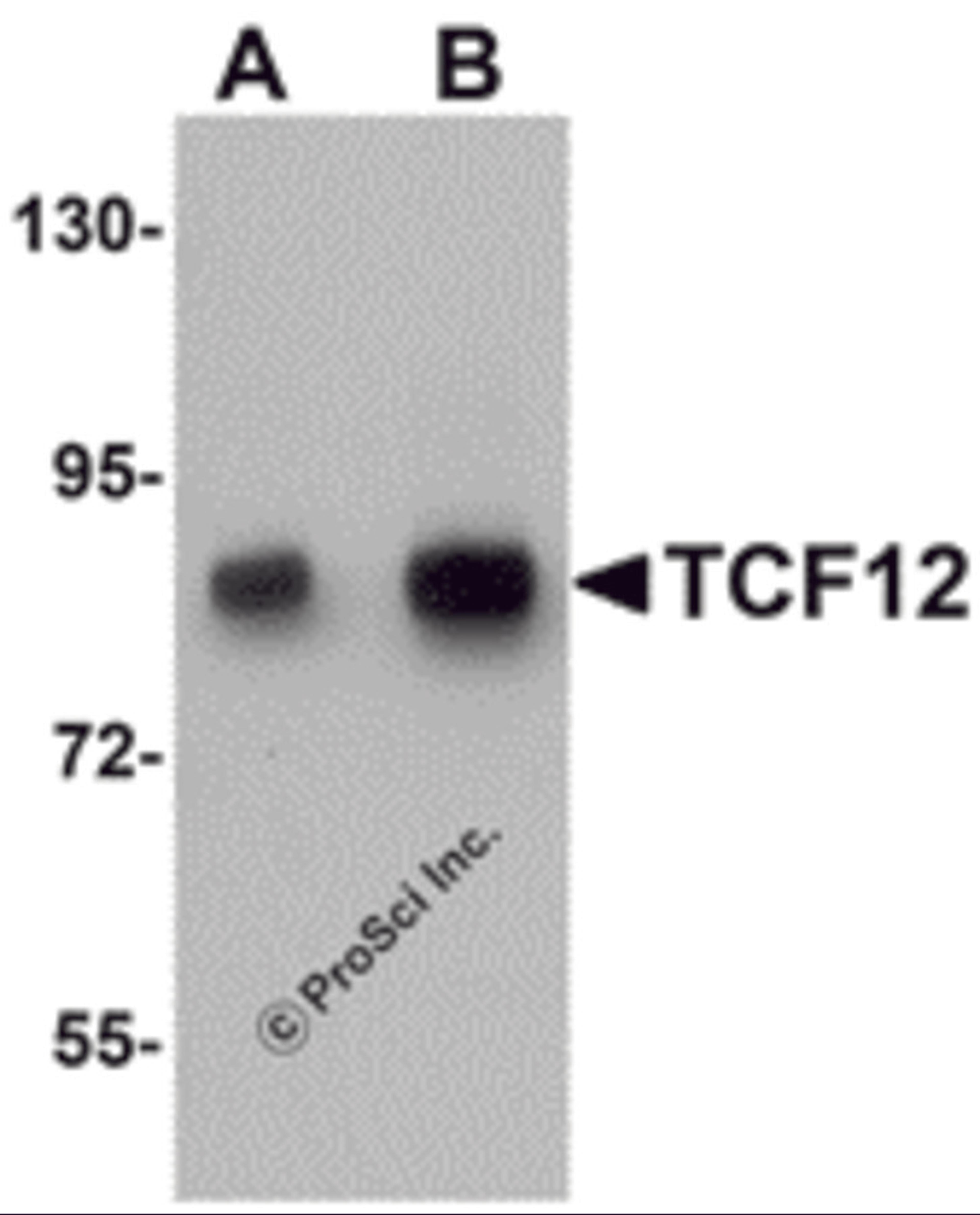 Western blot analysis of TCF12 in HeLa cell lysate with TCF12 antibody at (A) 0.5 and (B) 1 μg/mL.