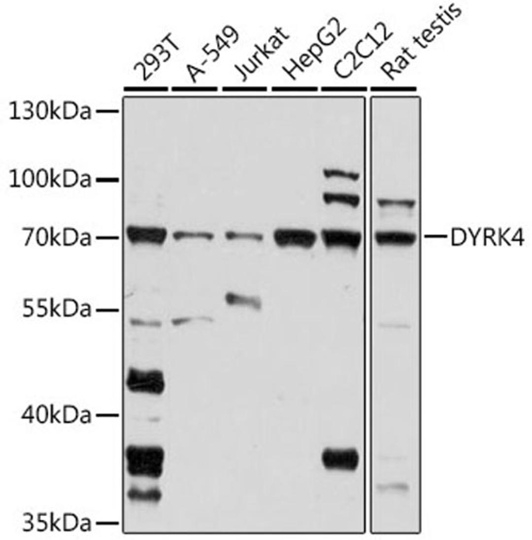 Western blot - DYRK4 antibody (A16460)