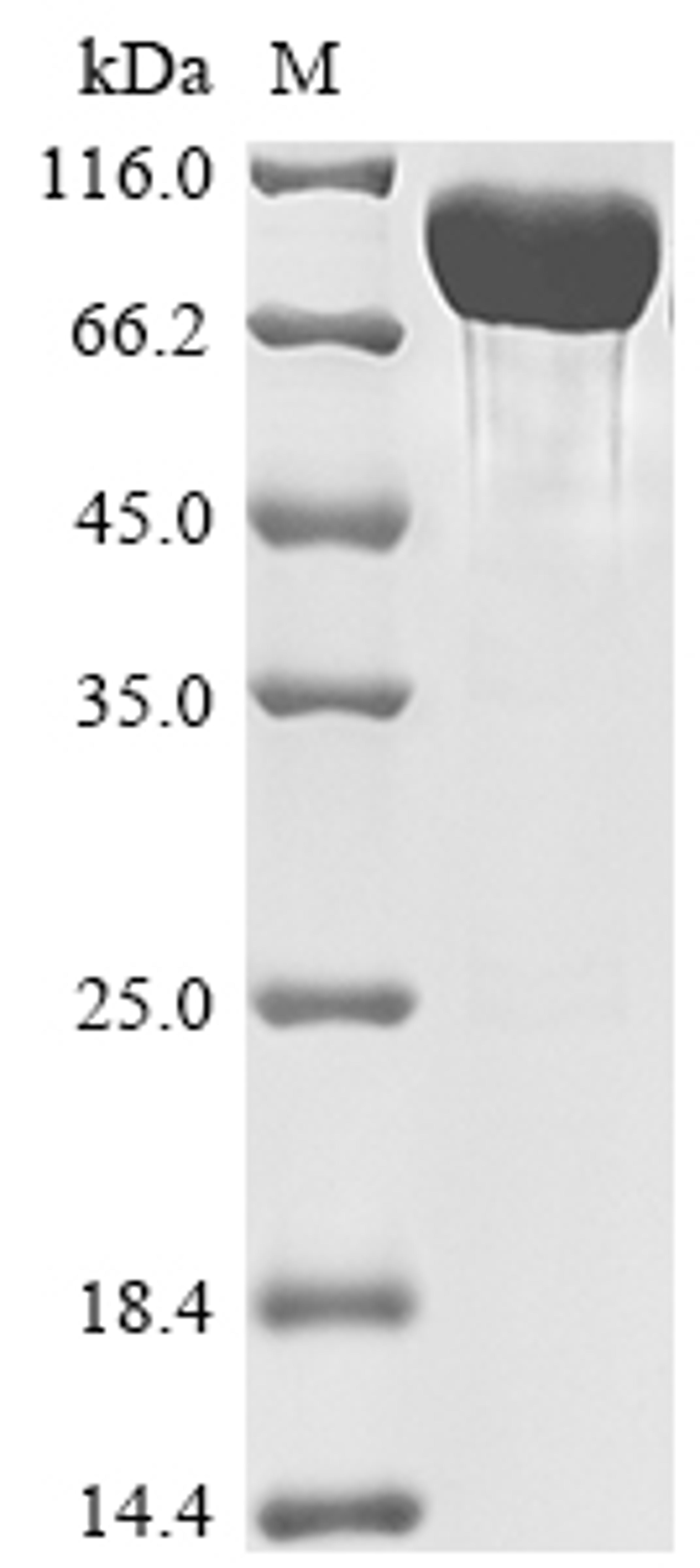 (Tris-Glycine gel) Discontinuous SDS-PAGE (reduced) with 5% enrichment gel and 15% separation gel.