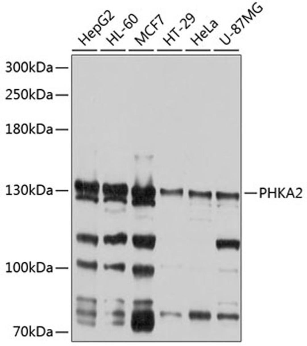 Western blot - PHKA2 antibody (A9636)