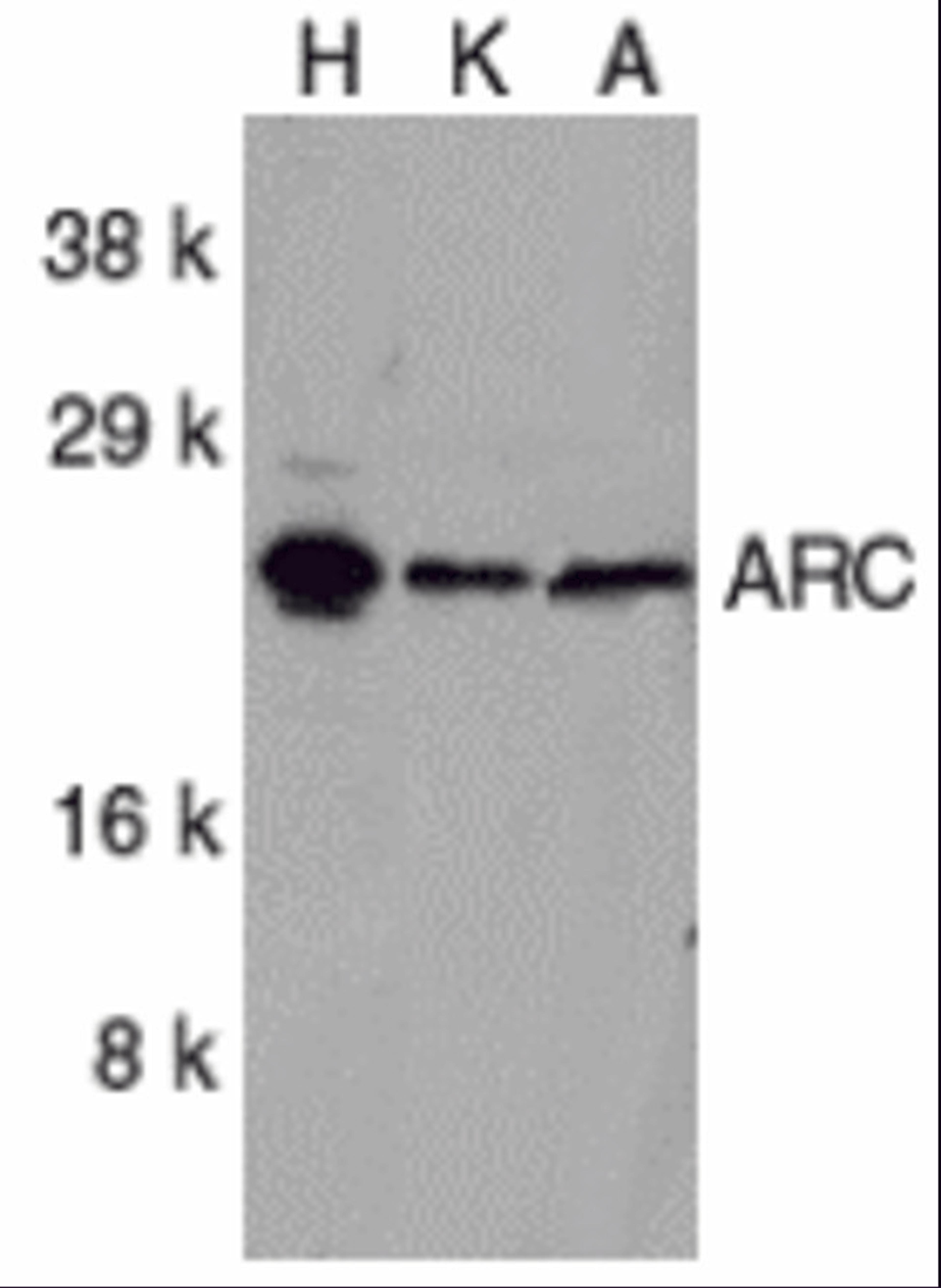 Western blot analysis of ARC in (H) HeLa, (K) K562, and (A) A549 whole cell lysates with ARC antibody at 1 &#956;g/mL.