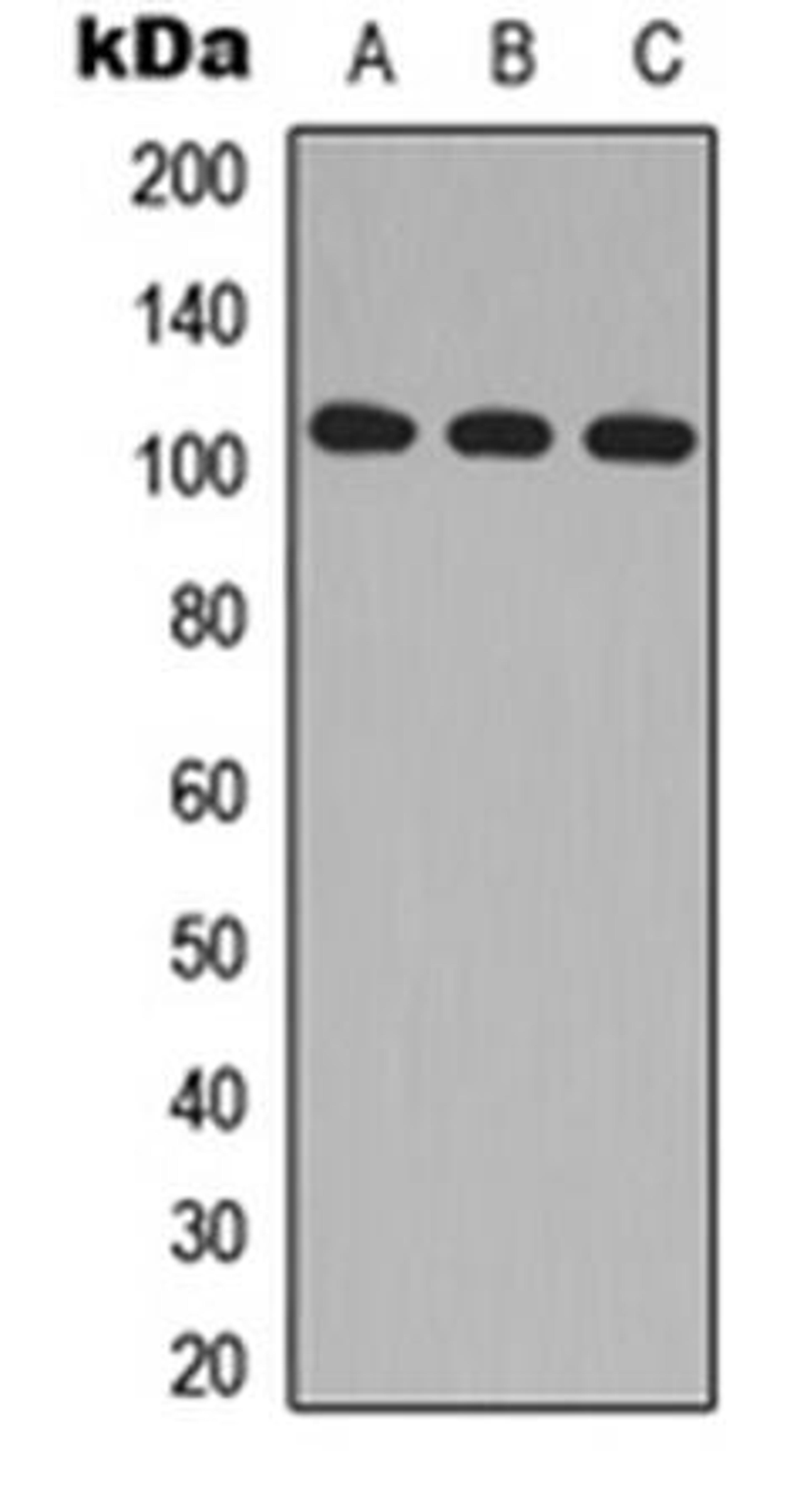 Western blot analysis of HeLa (Lane1), Raw264.7 (Lane2), H9C2 (Lane3) whole cell using MLK2 antibody