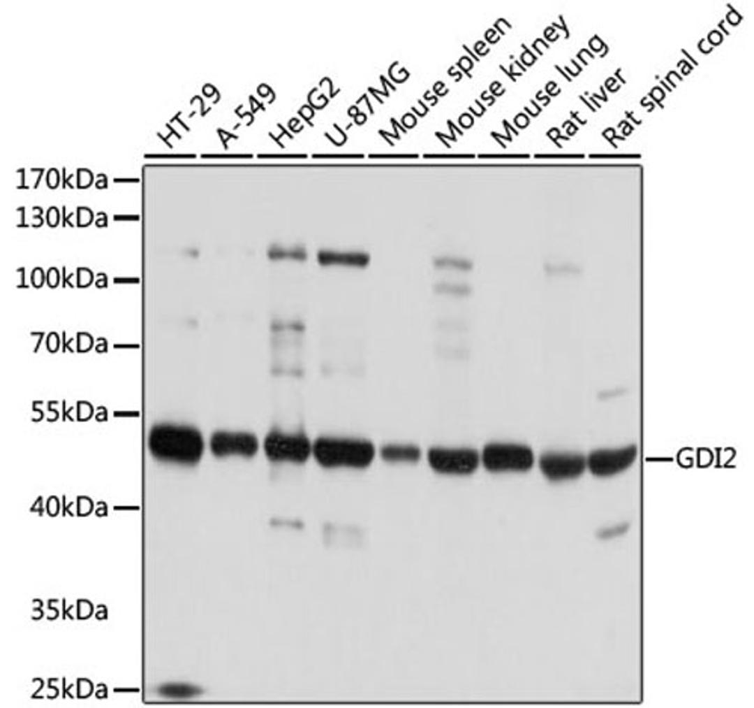 Western blot - GDI2 antibody (A8615)