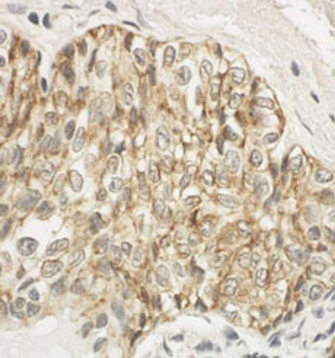 Detection of human JAM-A by immunohistochemistry.