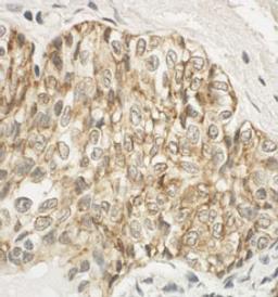 Detection of human JAM-A by immunohistochemistry.