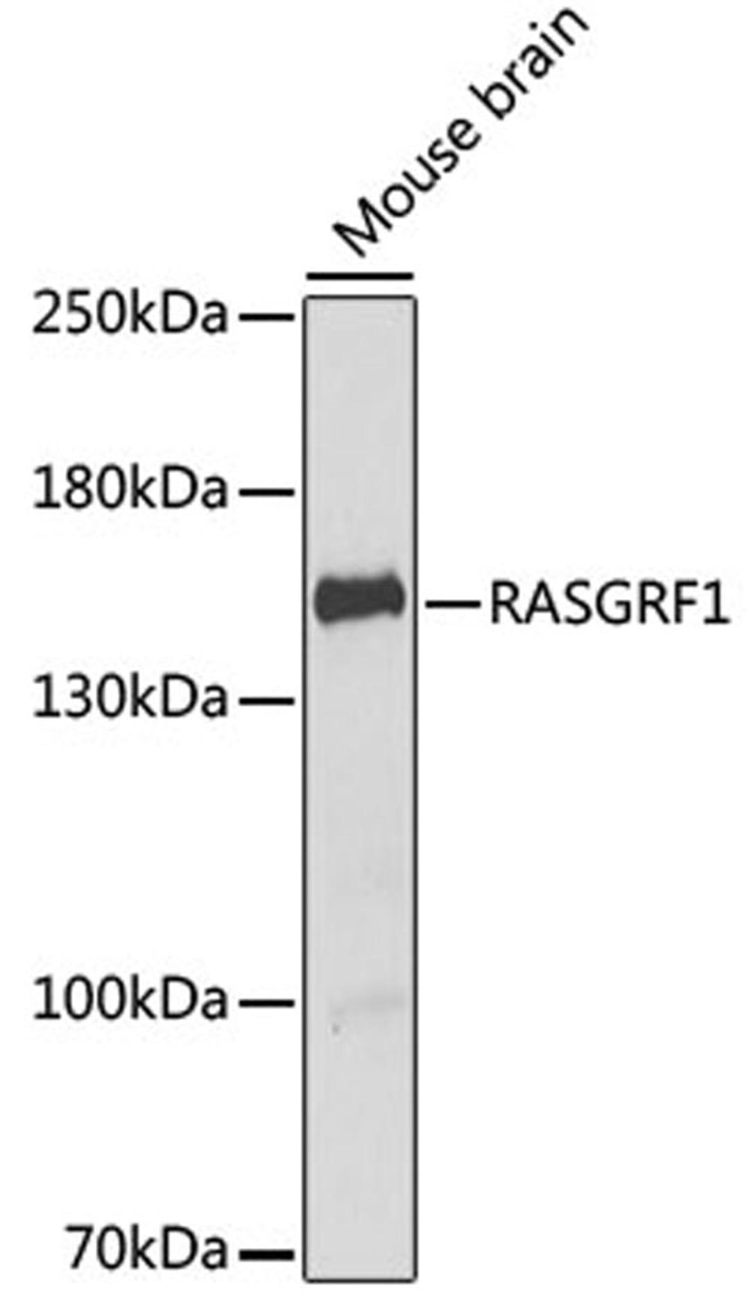 Western blot - RASGRF1 antibody (A6964)