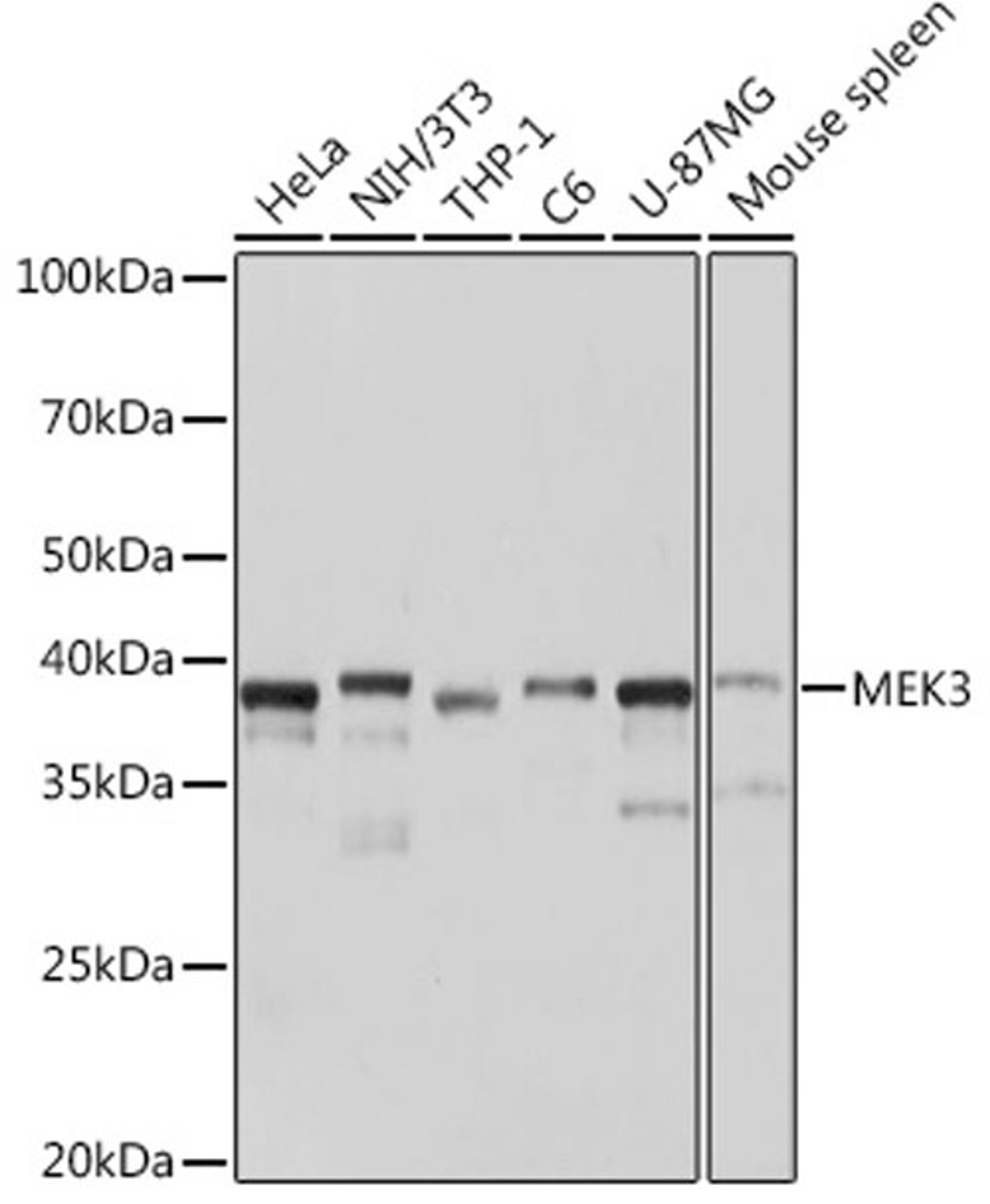Western blot - MEK3 Rabbit mAb (A3263)