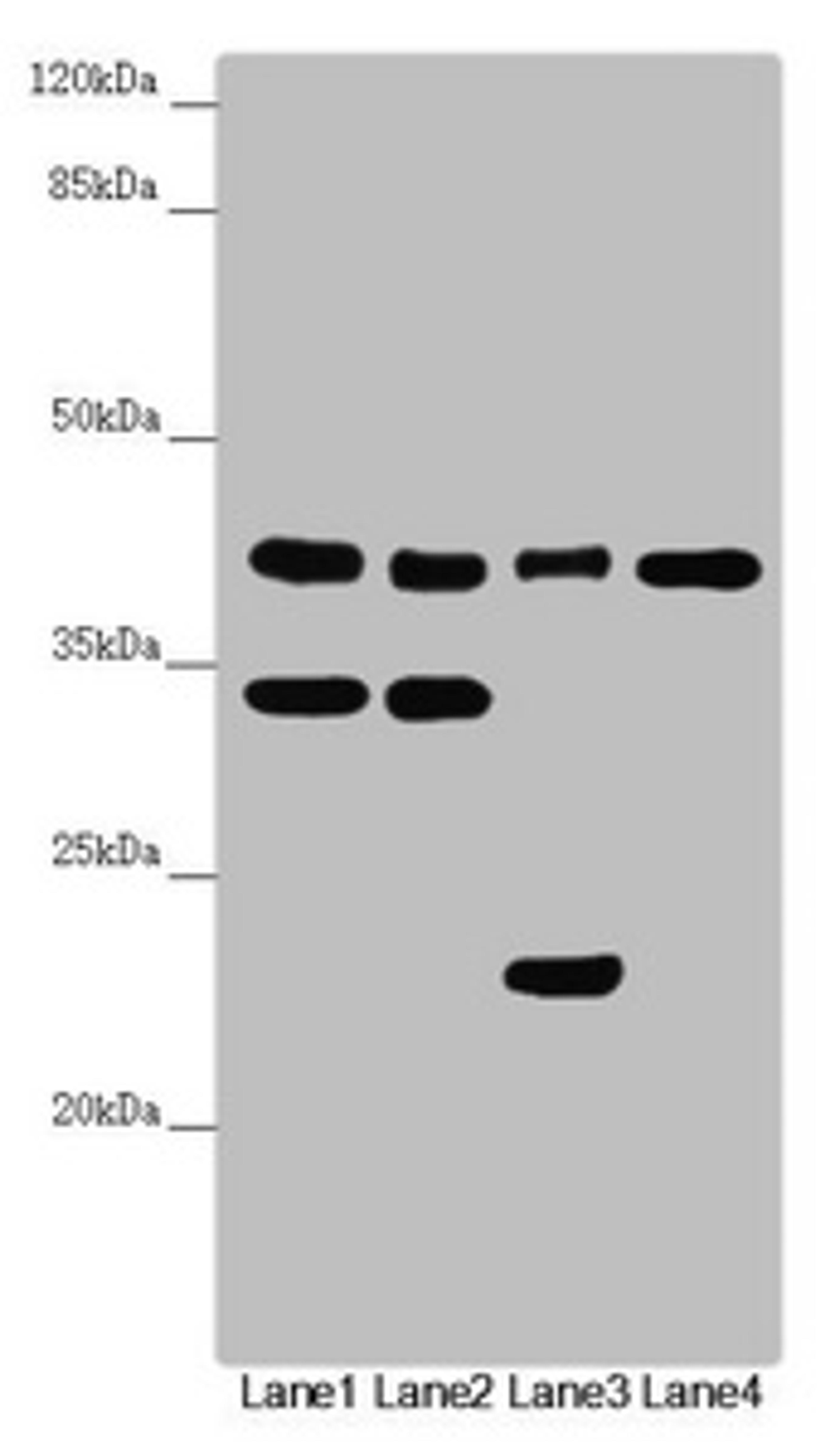 Western blot. All lanes: DSN1 antibody at 3.09 ug/ml. Lane 1: Hela whole cell lysate. Lane 2: MCF-7 whole cell lysate. Lane 3: Mouse lung tissue. Lane 4: Mouse gonadal tissue. Secondary. Goat polyclonal to rabbit IgG at 1/10000 dilution. Predicted band size: 41, 33, 39, 28 kDa. Observed band size: 41, 34, 23 kDa. 
