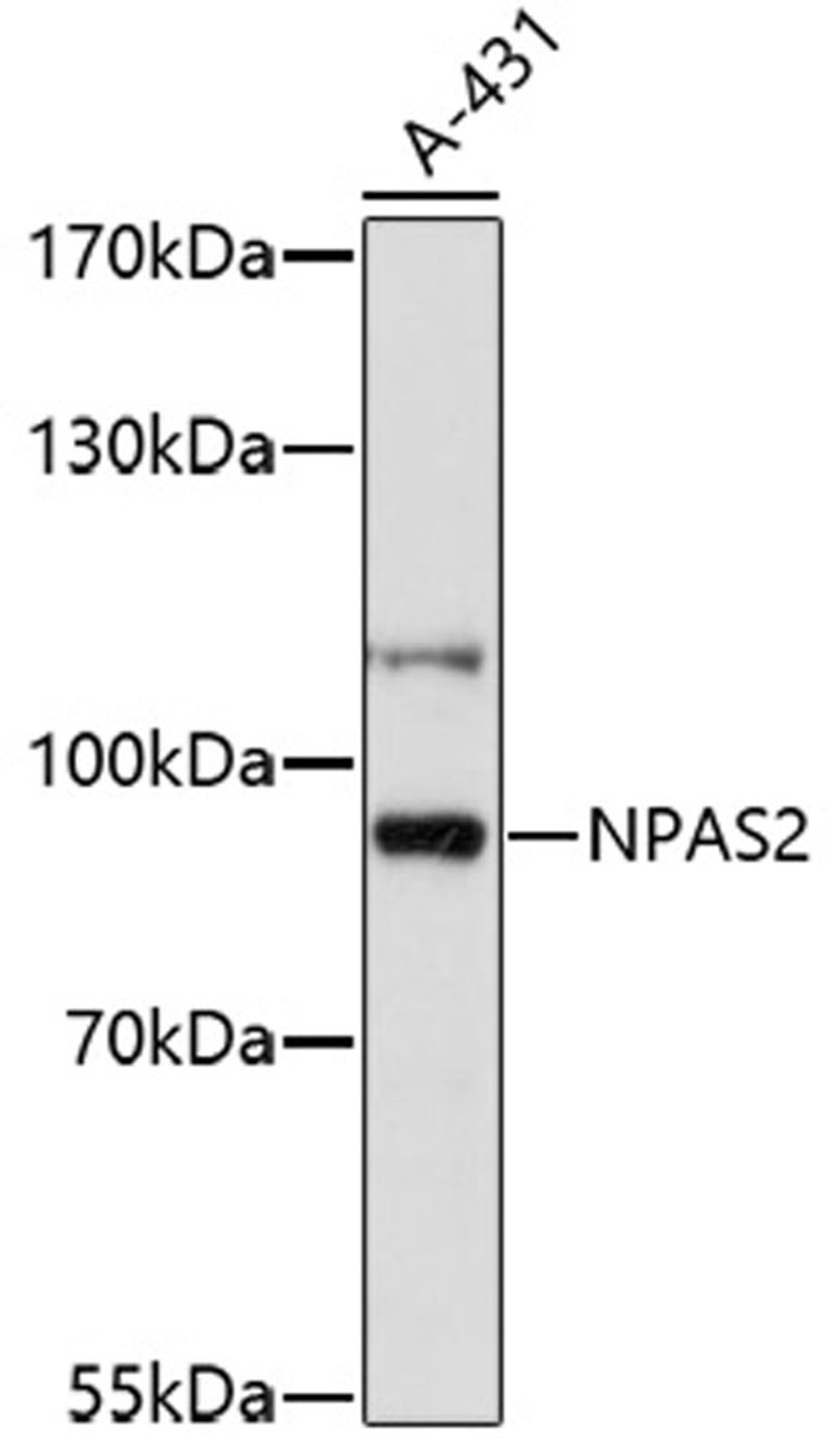 Western blot - NPAS2 antibody (A16930)