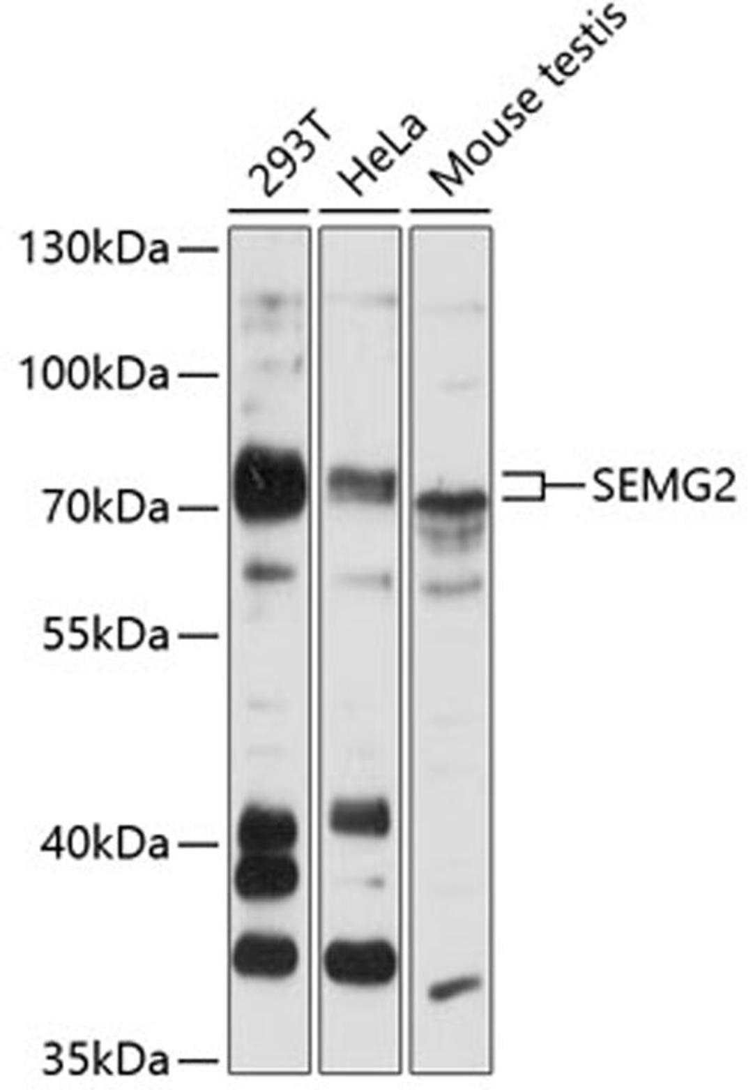 Western blot - SEMG2 antibody (A12826)