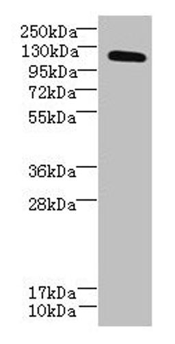 Western blot. All lanes: DIS3L antibody at 6µg/ml + MCF-7 whole cell lysate. Secondary. Goat polyclonal to rabbit IgG at 1/10000 dilution. Predicted band size: 121, 106, 87, 112 kDa. Observed band size: 121 kDa