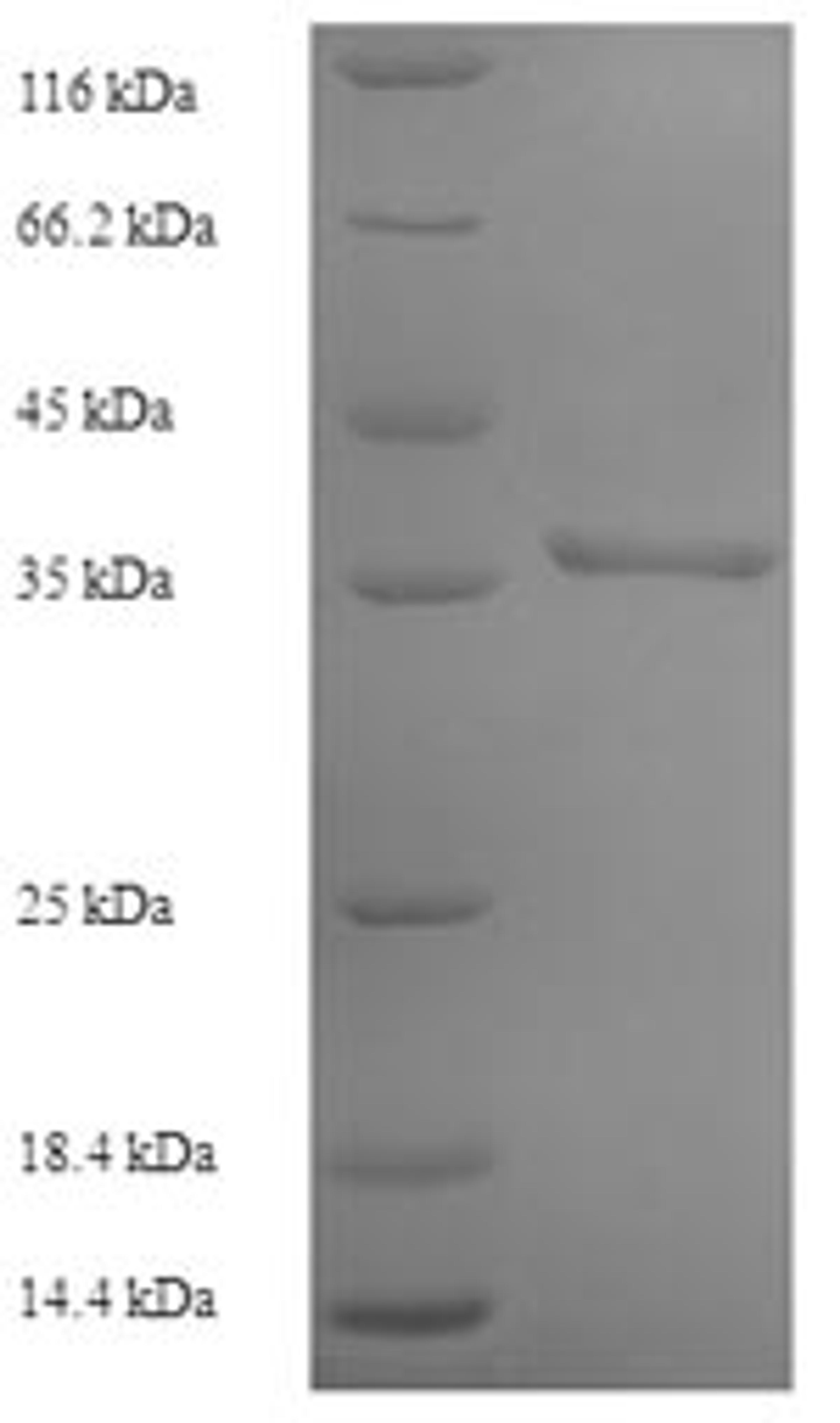 (Tris-Glycine gel) Discontinuous SDS-PAGE (reduced) with 5% enrichment gel and 15% separation gel.