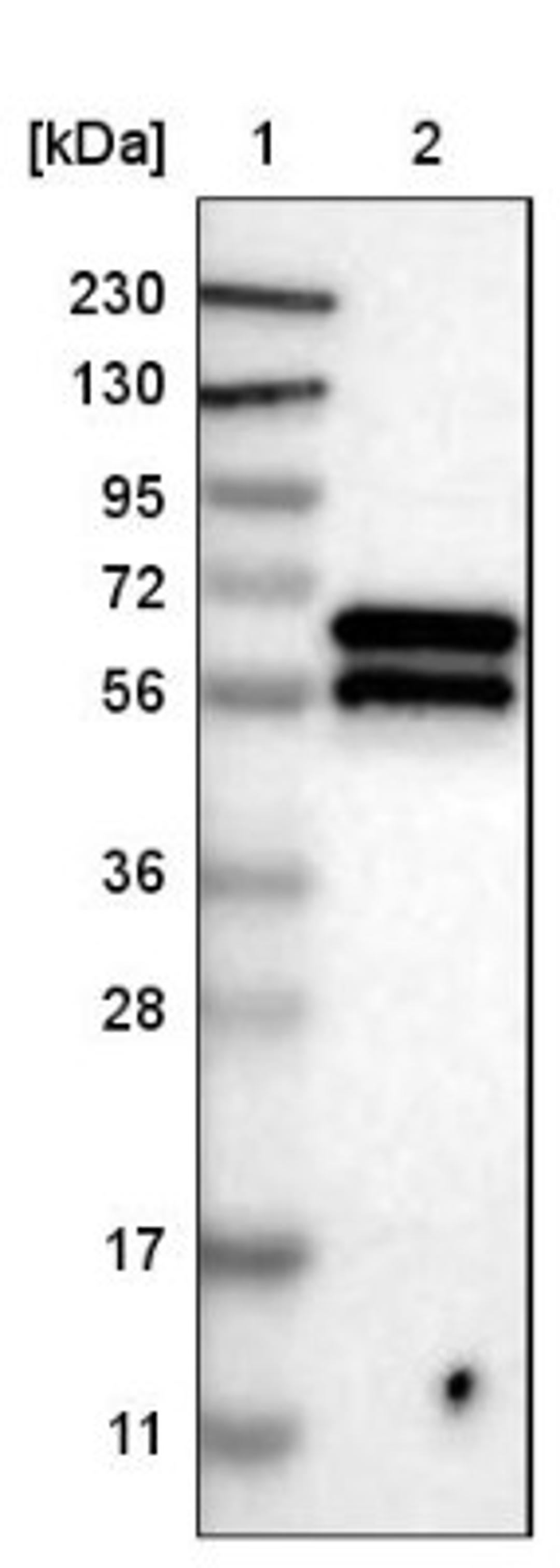 Western Blot: ARFGAP2 Antibody [NBP1-83687] - Lane 1: Marker [kDa] 230, 130, 95, 72, 56, 36, 28, 17, 11<br/>Lane 2: Human cell line RT-4